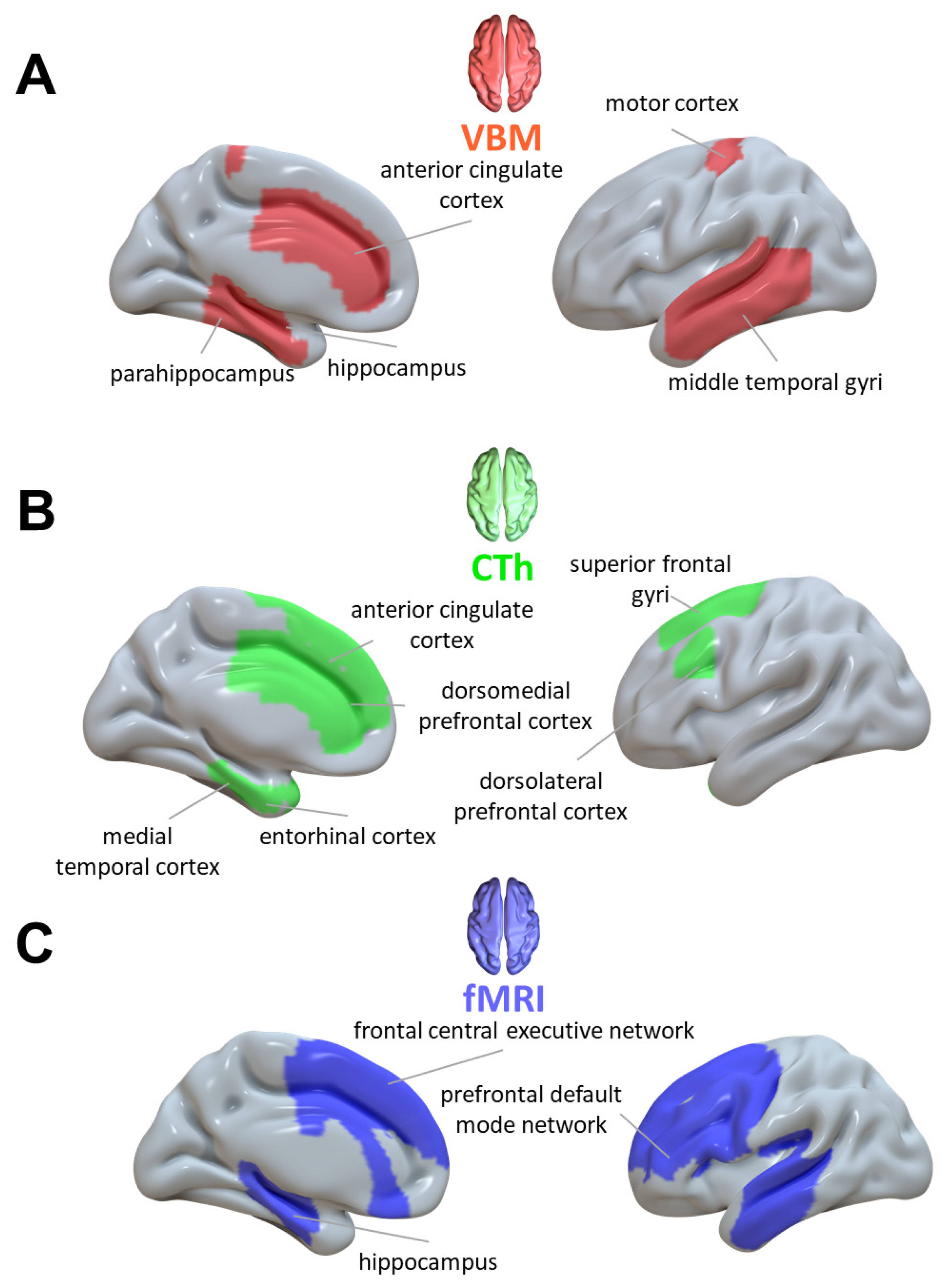 Brainsci 13 00923 g002 Brainsci 13 00923 g002