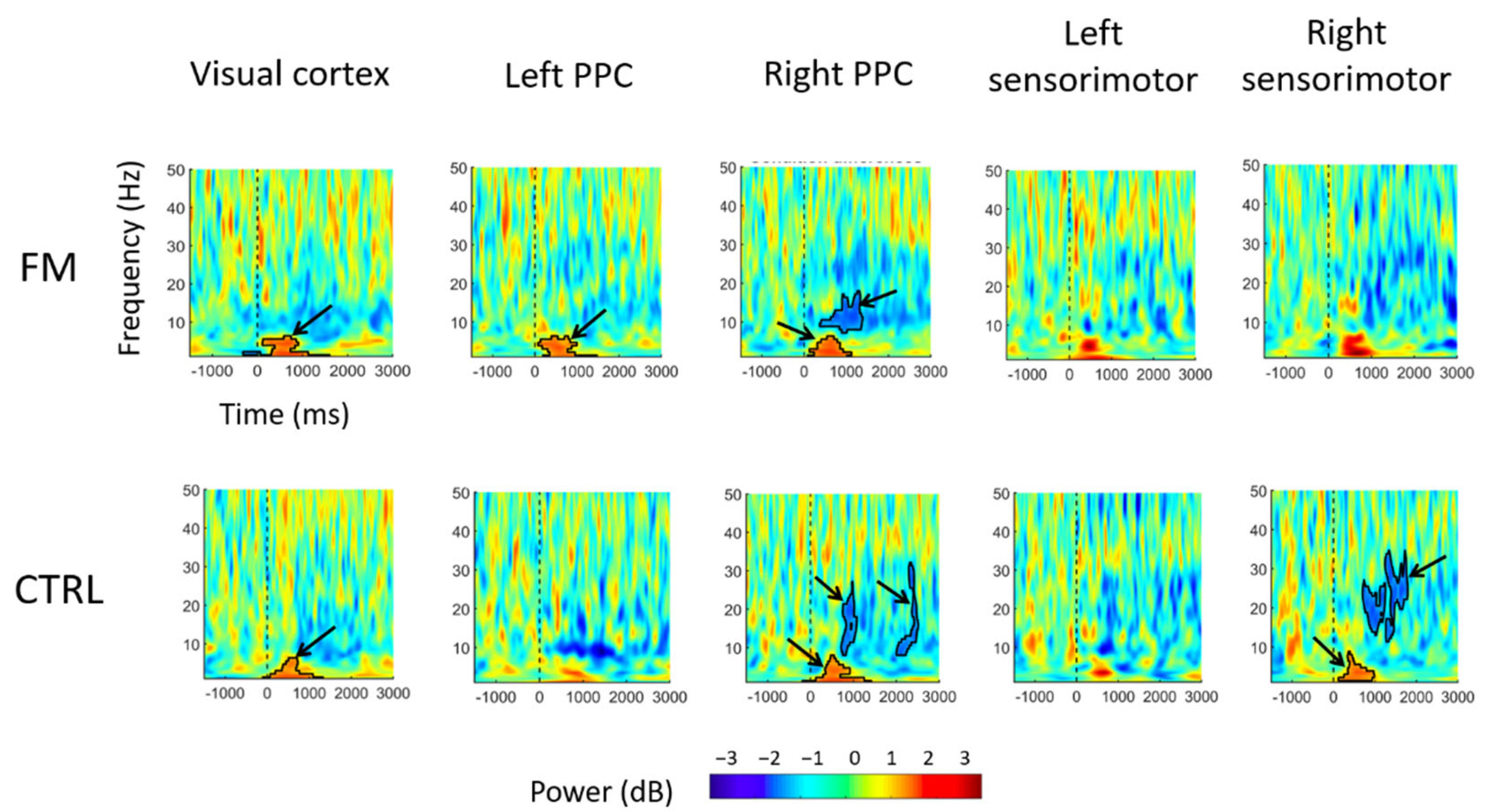 Brainsci 13 00931 g005 Brainsci 13 00931 g005