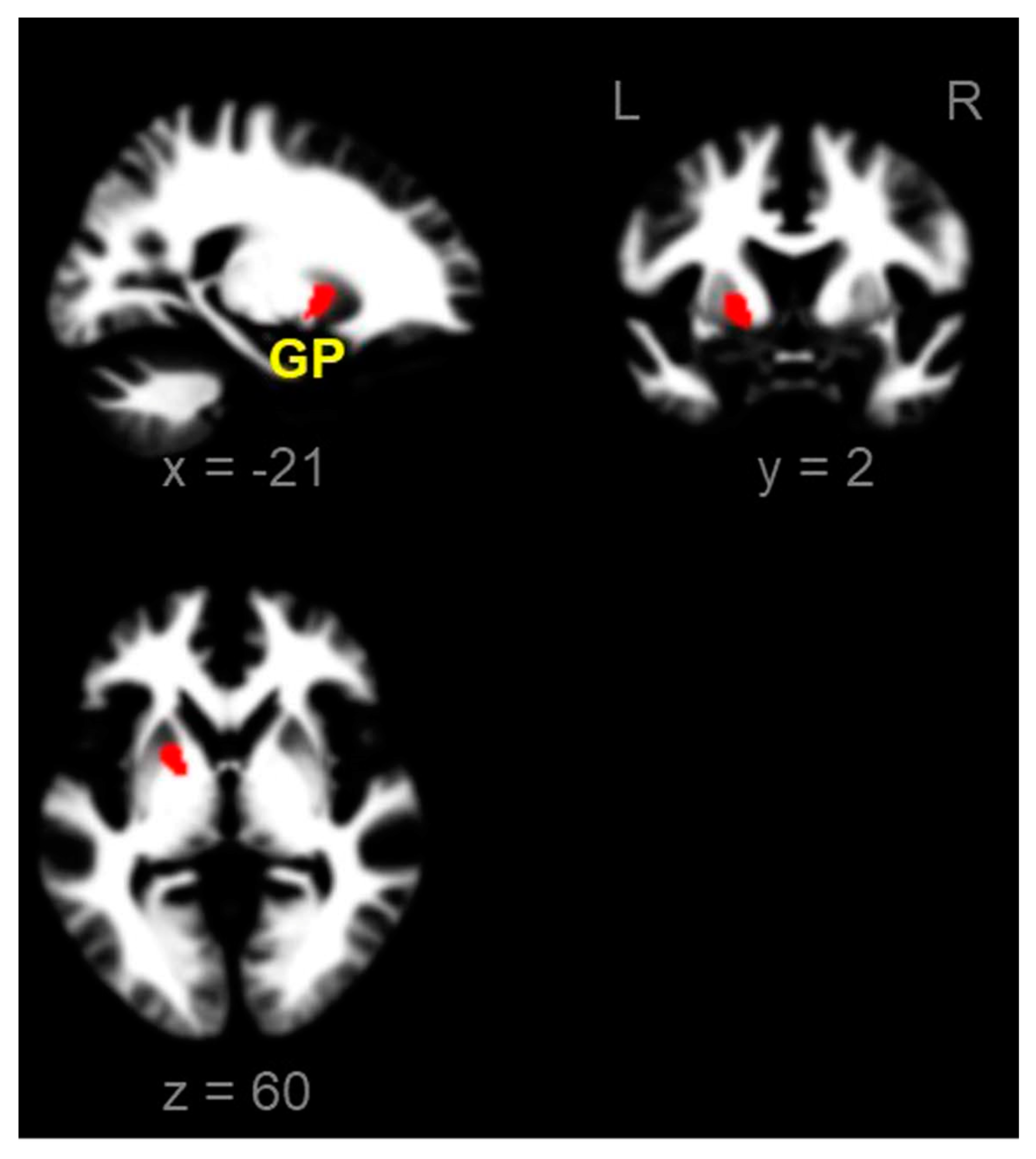 Brainsci 13 00942 g002 Brainsci 13 00942 g002