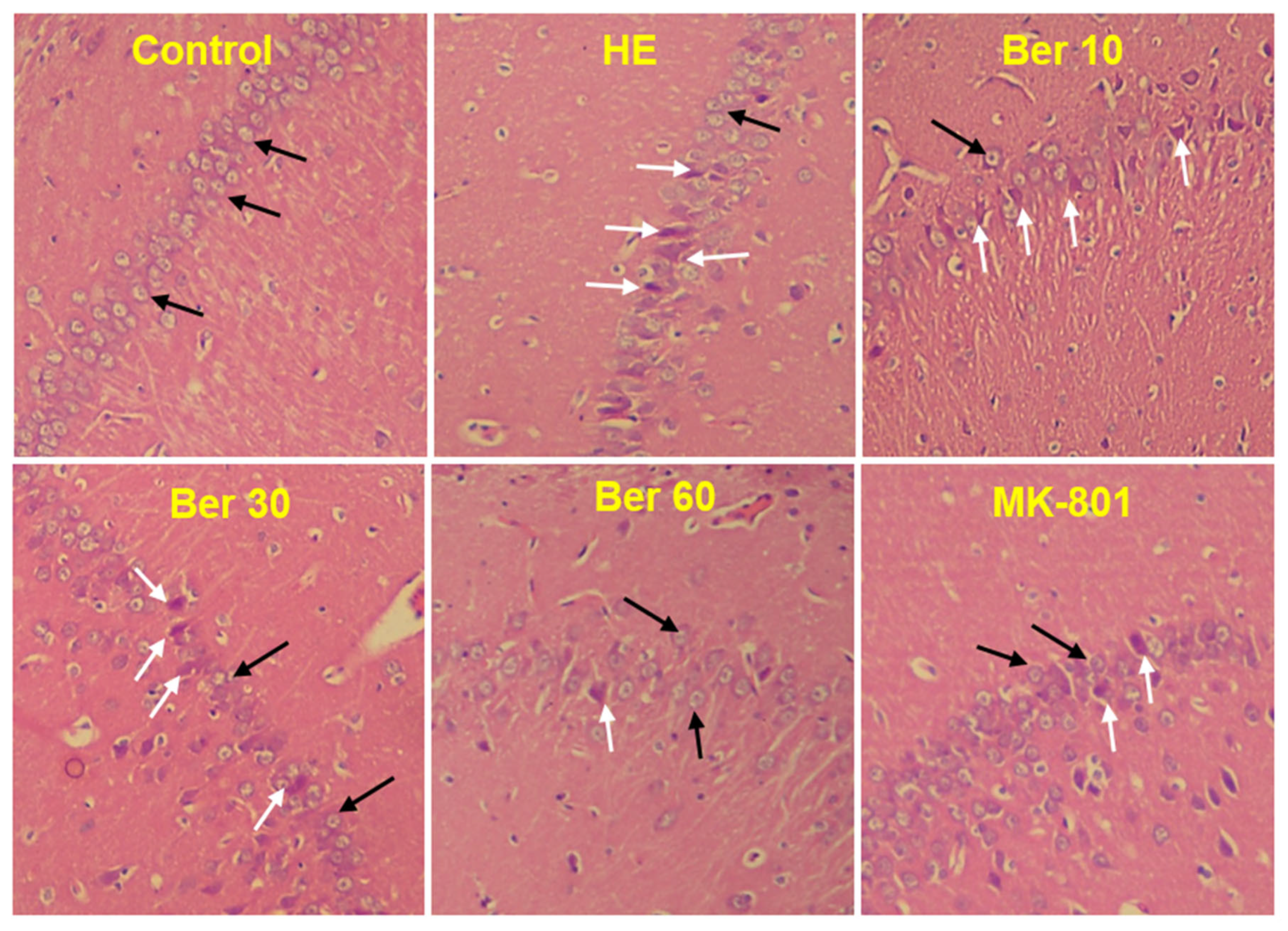 Brainsci 13 00944 g008 Brainsci 13 00944 g008