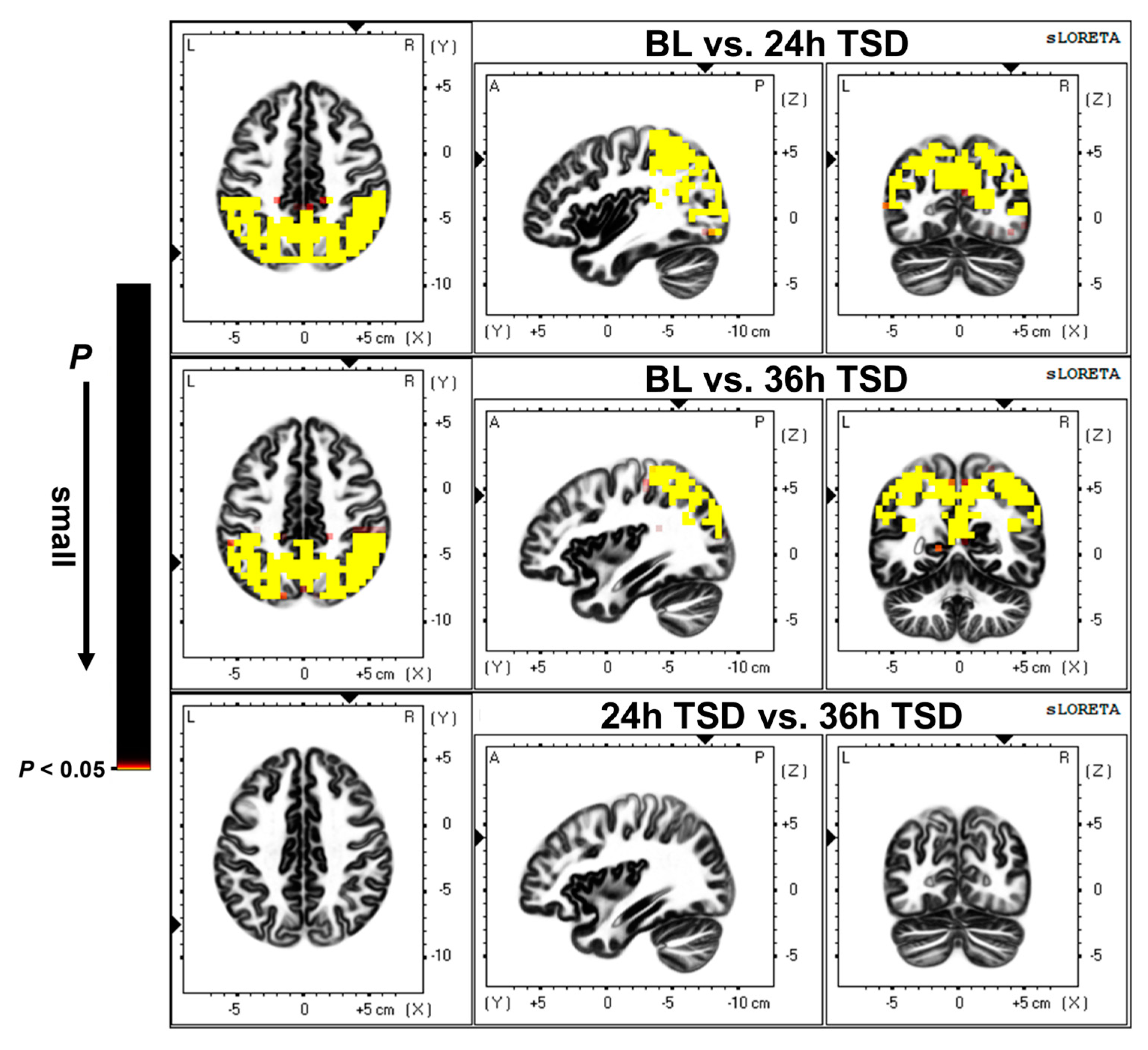 Brainsci 13 00949 g002 Brainsci 13 00949 g002
