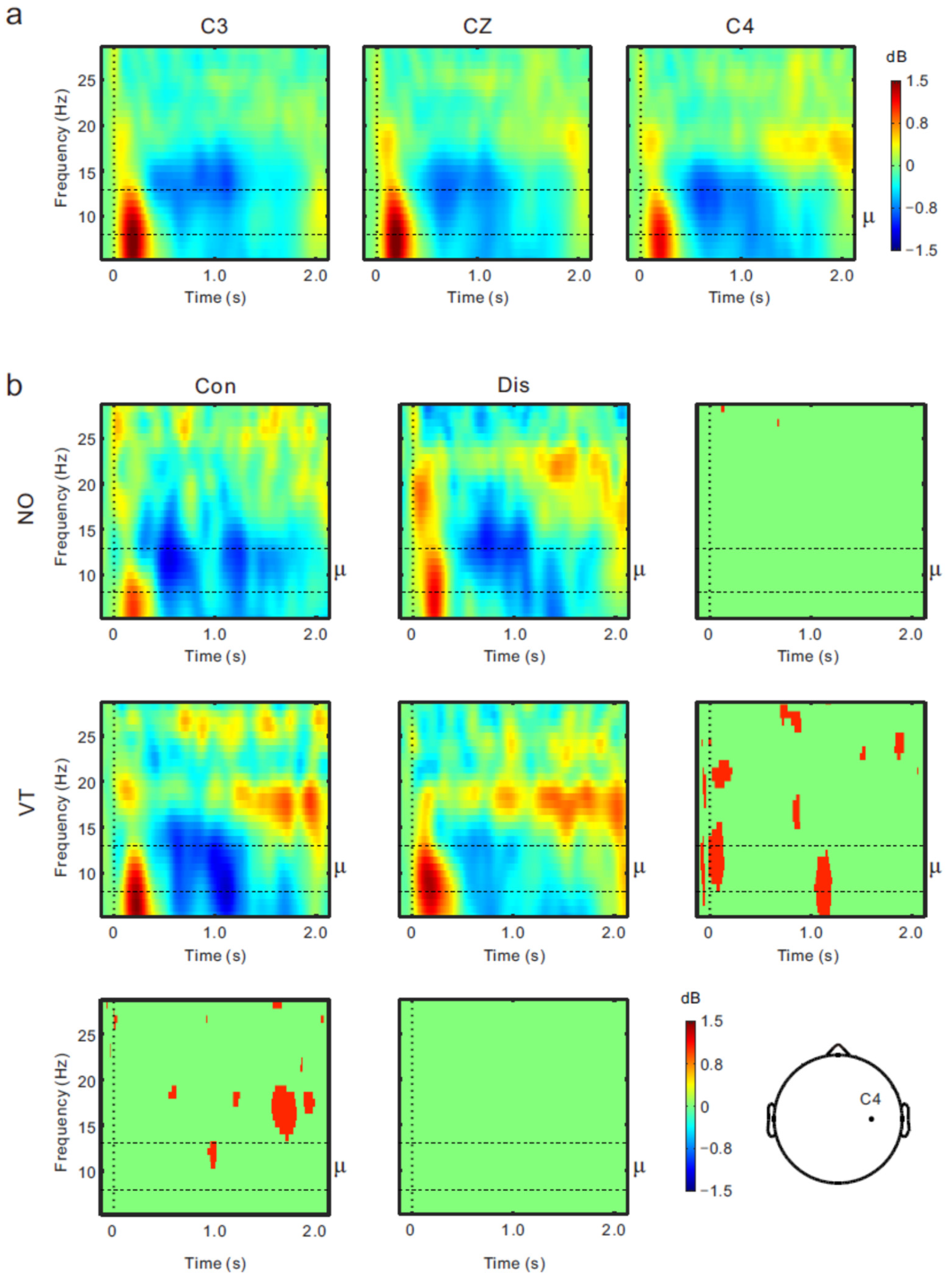Brainsci 13 00969 g005 Brainsci 13 00969 g005