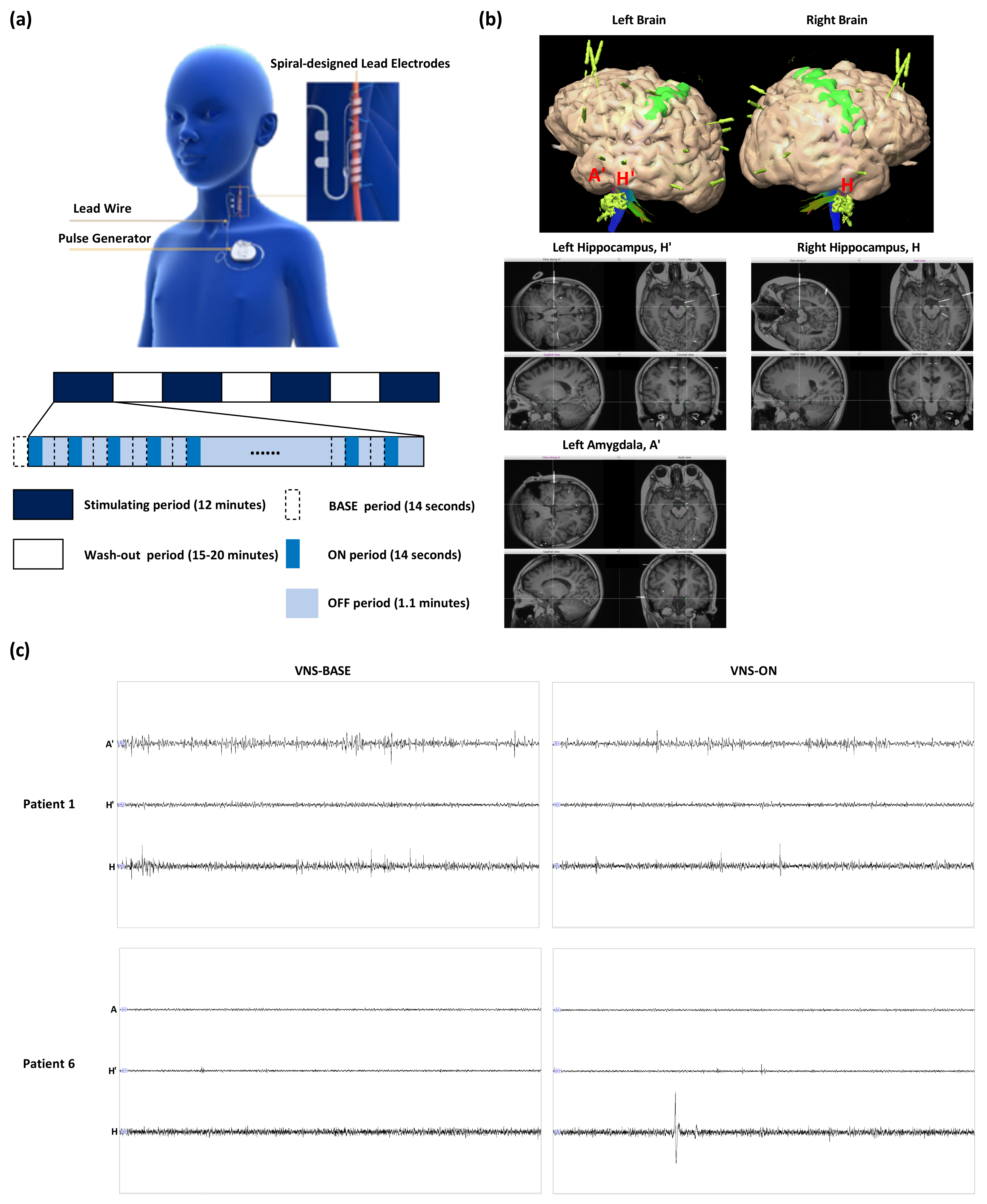 Brainsci 13 00976 g001