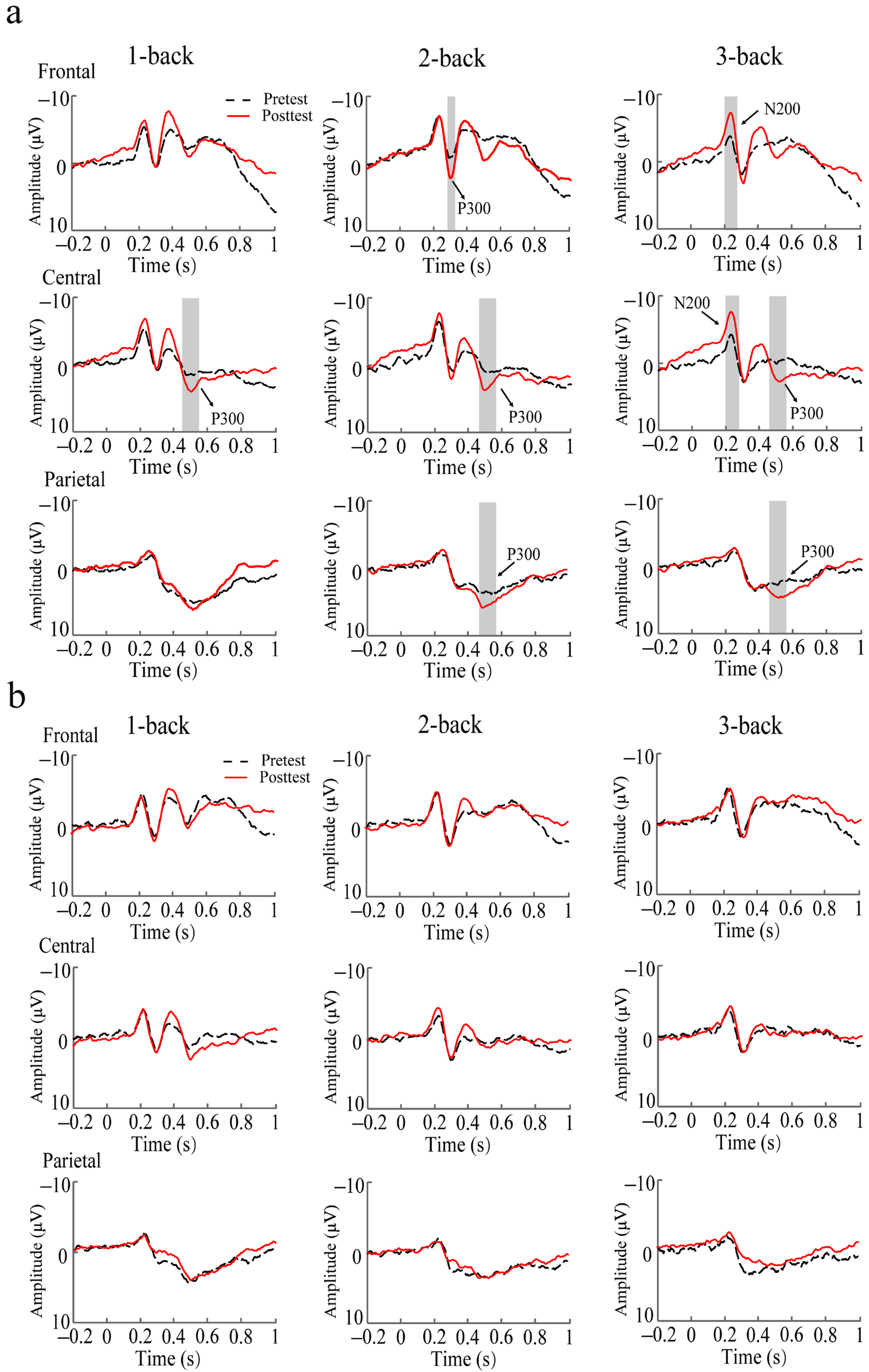 Brainsci 13 00992 g006 Brainsci 13 00992 g006