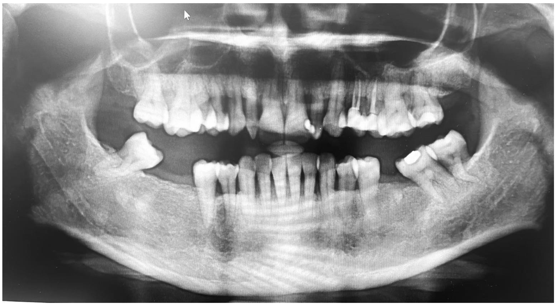 Brainsci 13 01009 g004