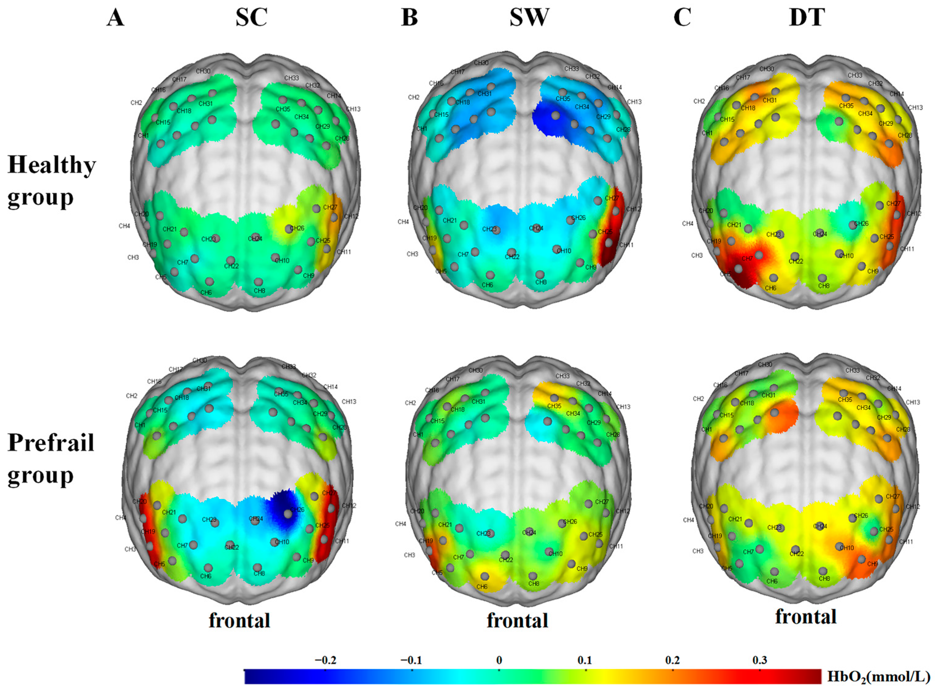 Cerebral Cortex Activation and Gait Performance between