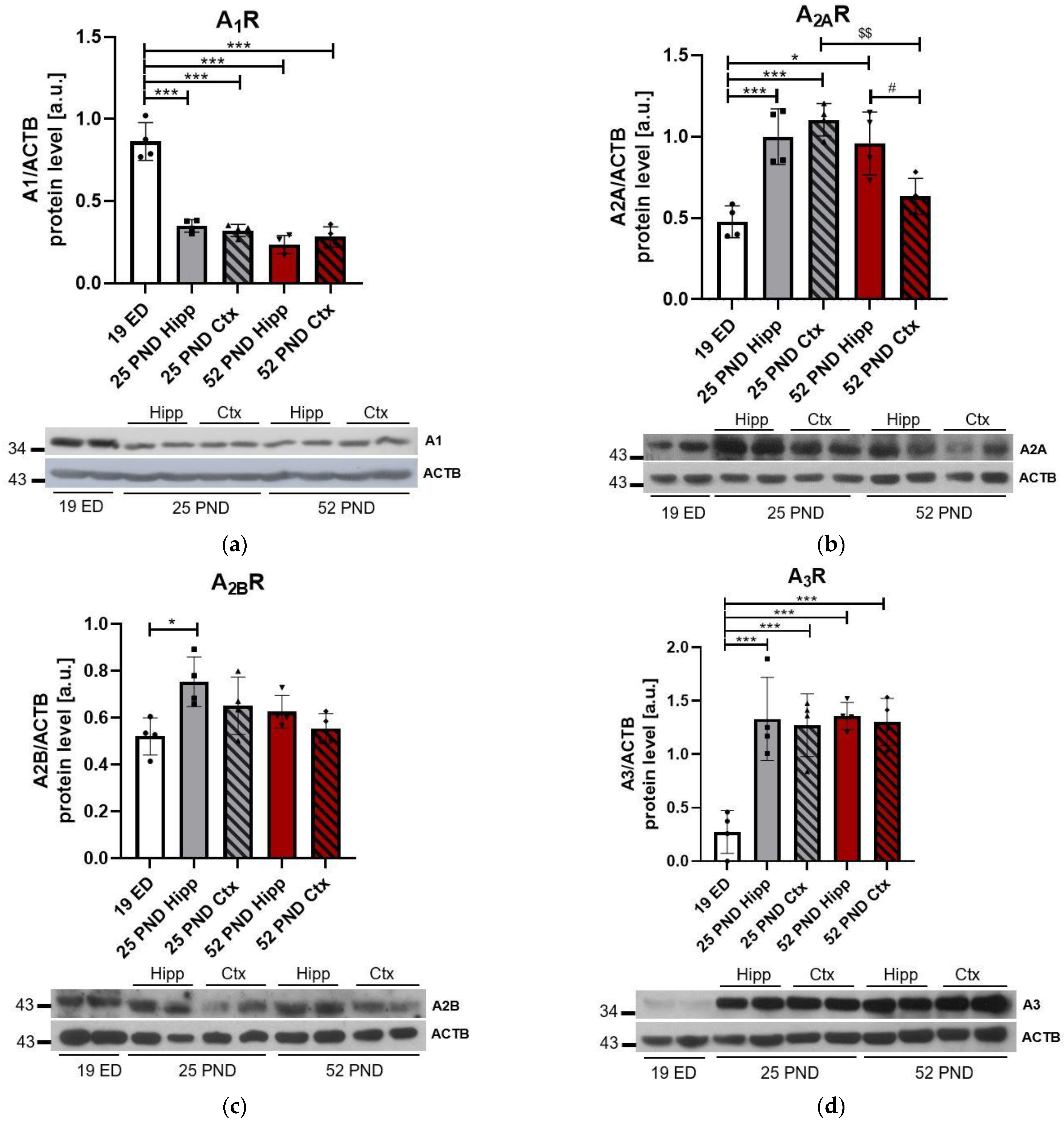 Brain Sciences Free Full-Text Alterations of Purinergic Receptors Levels and Their Involvement in the Glial Cell Morphology in a Pre-Clinical Model of Autism Spectrum Disorders