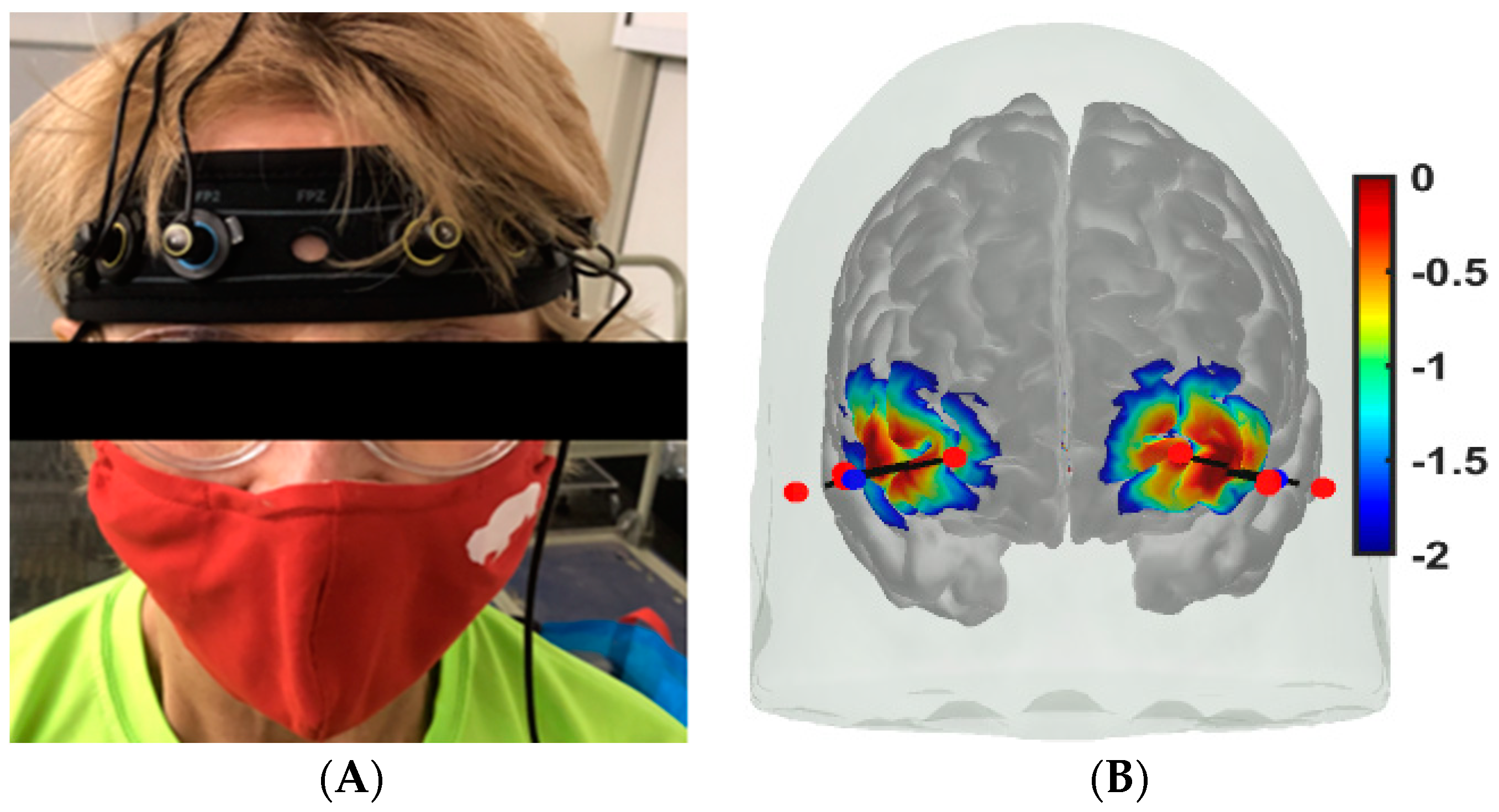 Brainsci 13 01099 g003 Brainsci 13 01099 g003