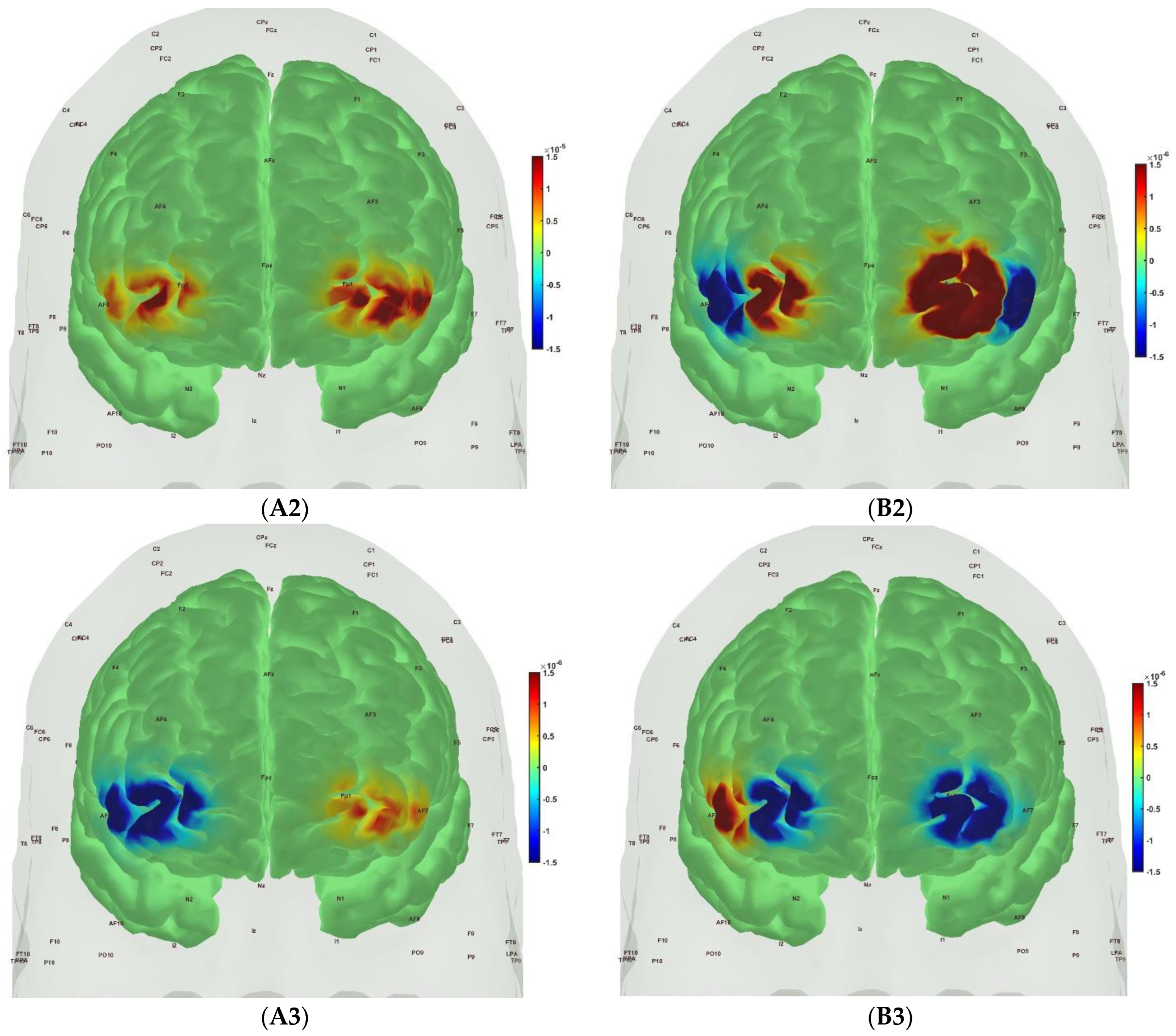 Brainsci 13 01099 g006b Brainsci 13 01099 g006b