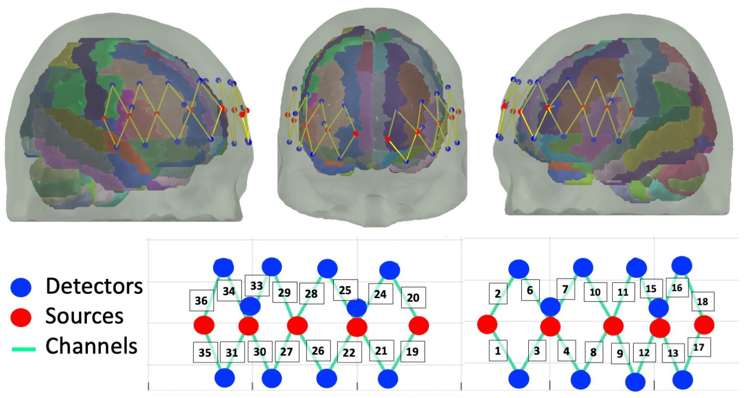 Brainsci 13 01113 g003 Brainsci 13 01113 g003