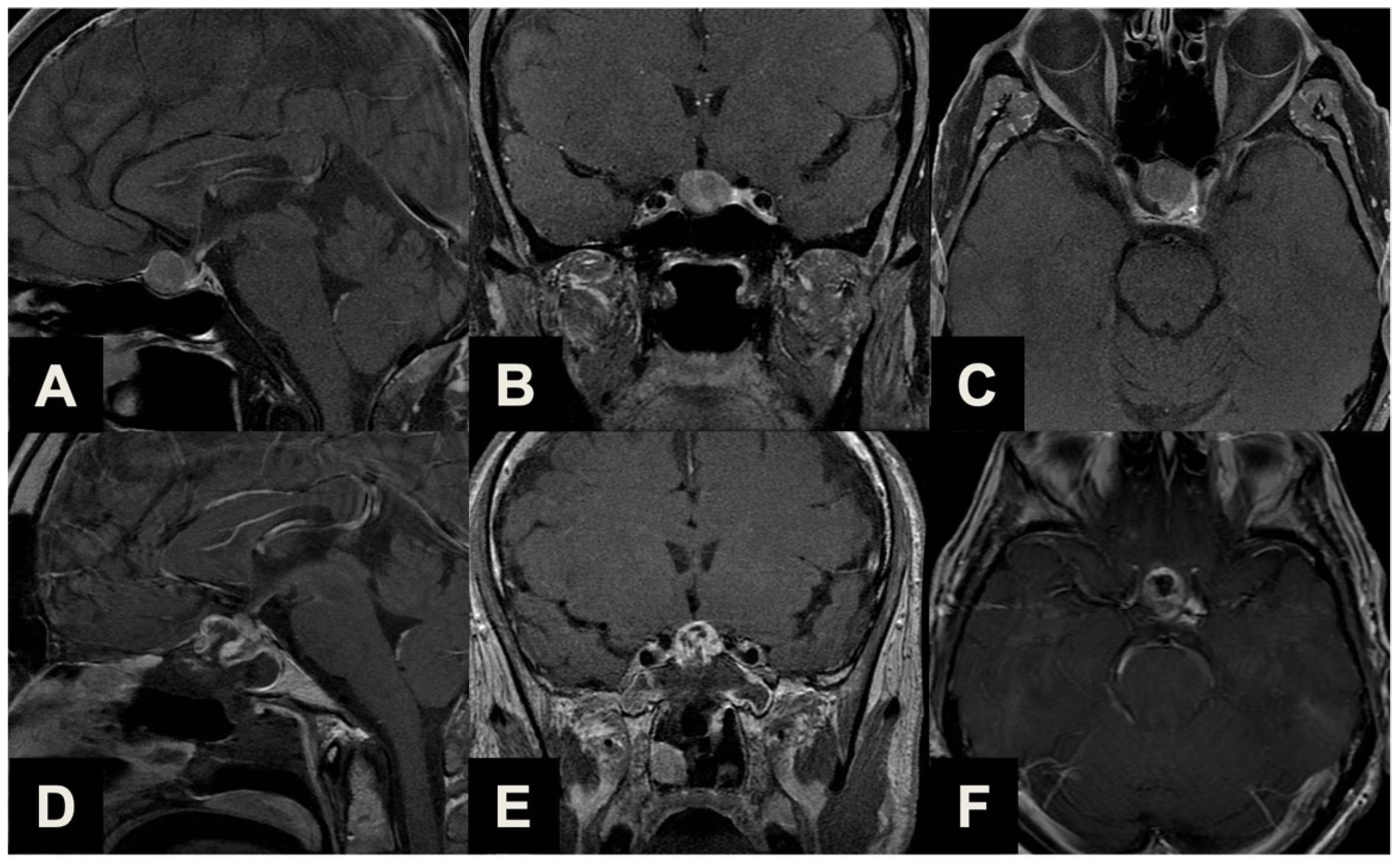 Brainsci 13 01121 g003 Brainsci 13 01121 g003
