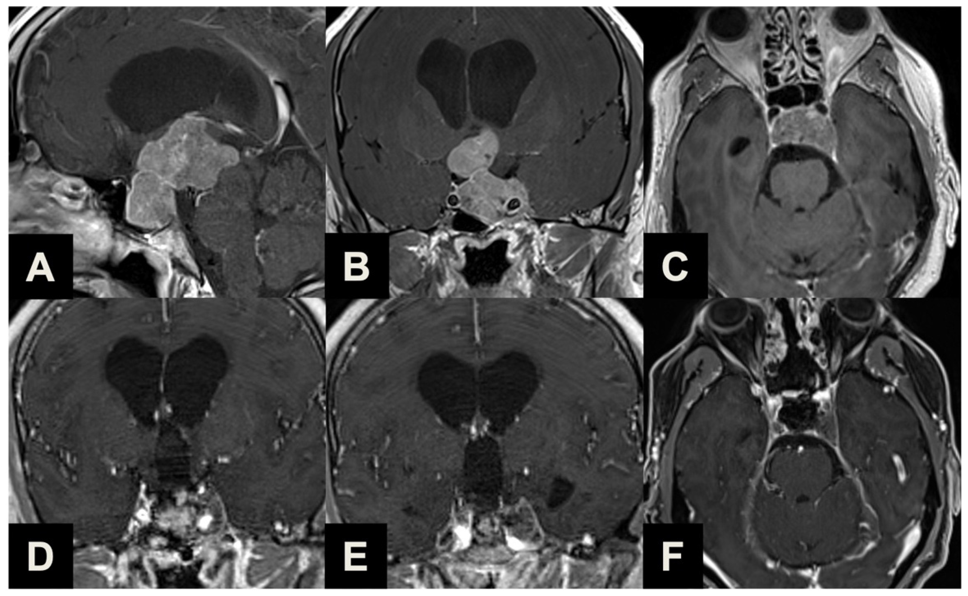 Brainsci 13 01121 g004 Brainsci 13 01121 g004