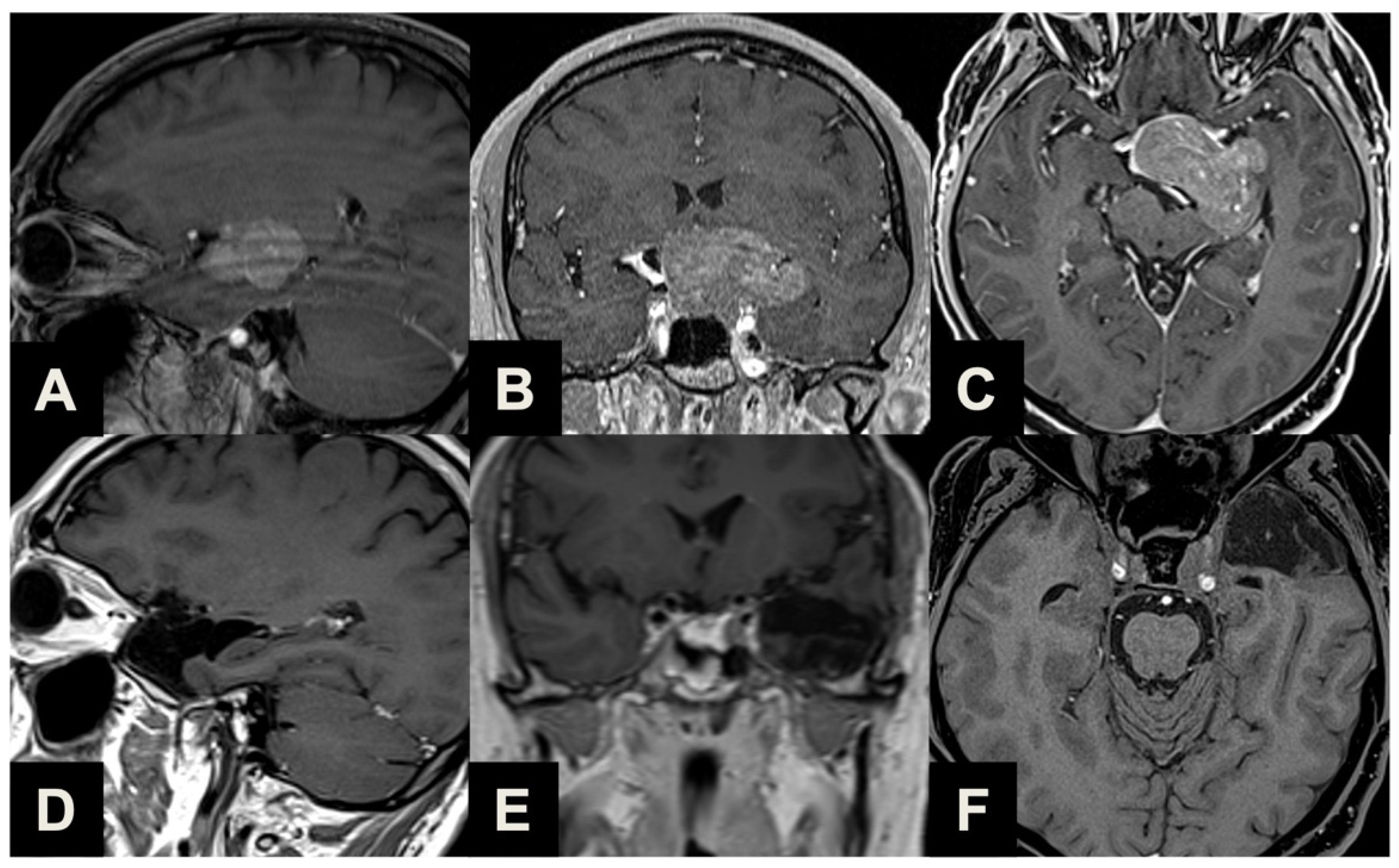 Brainsci 13 01121 g005 Brainsci 13 01121 g005