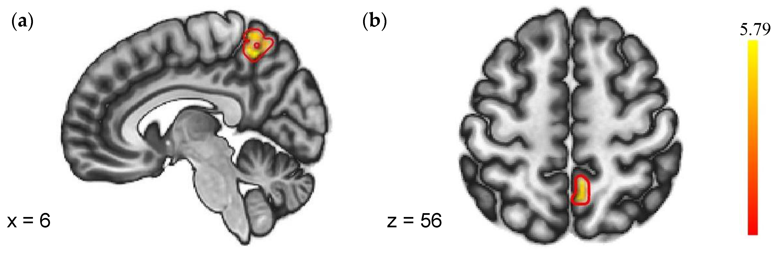 Brainsci 13 01122 g004 Brainsci 13 01122 g004