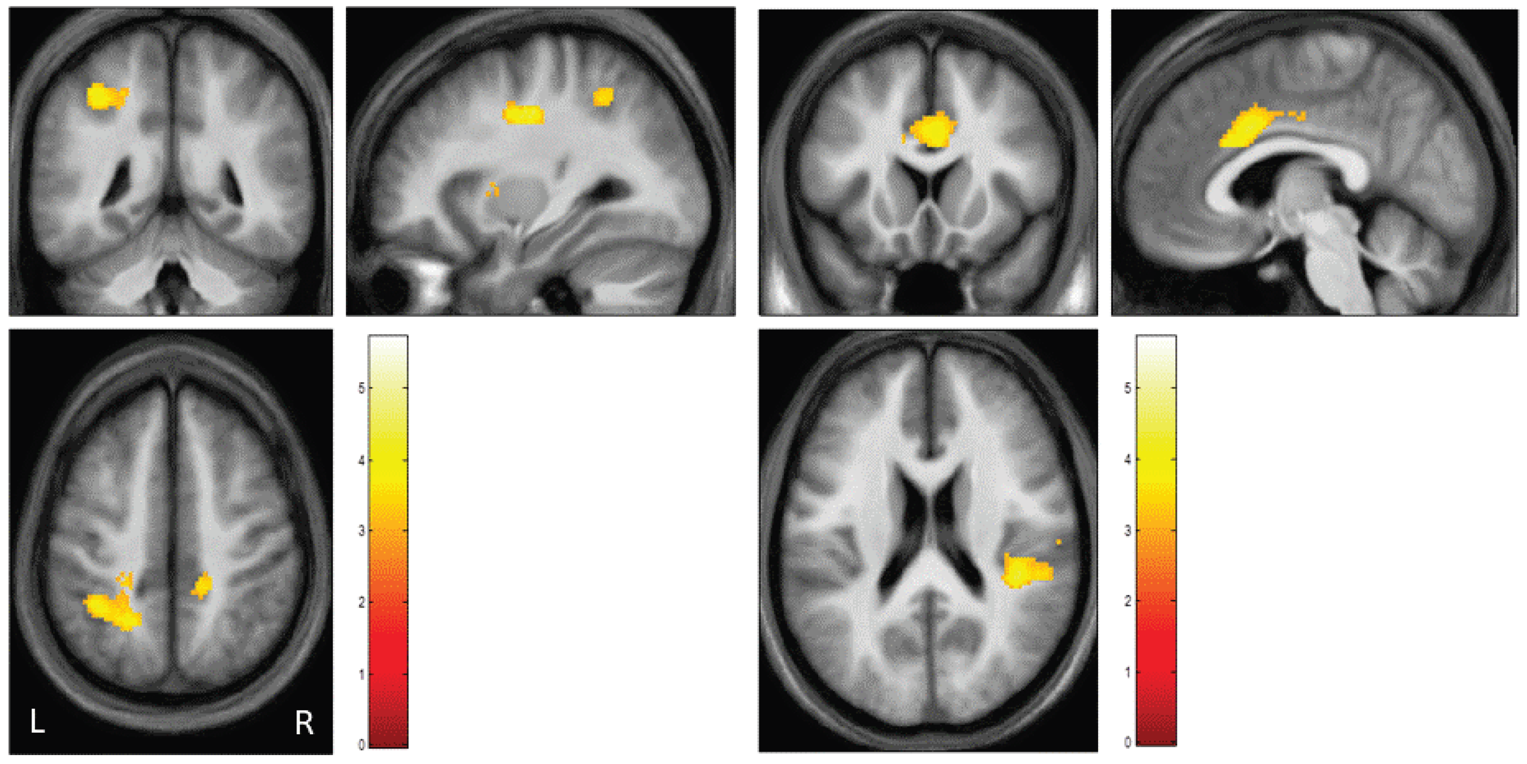 Brainsci 13 01125 g003