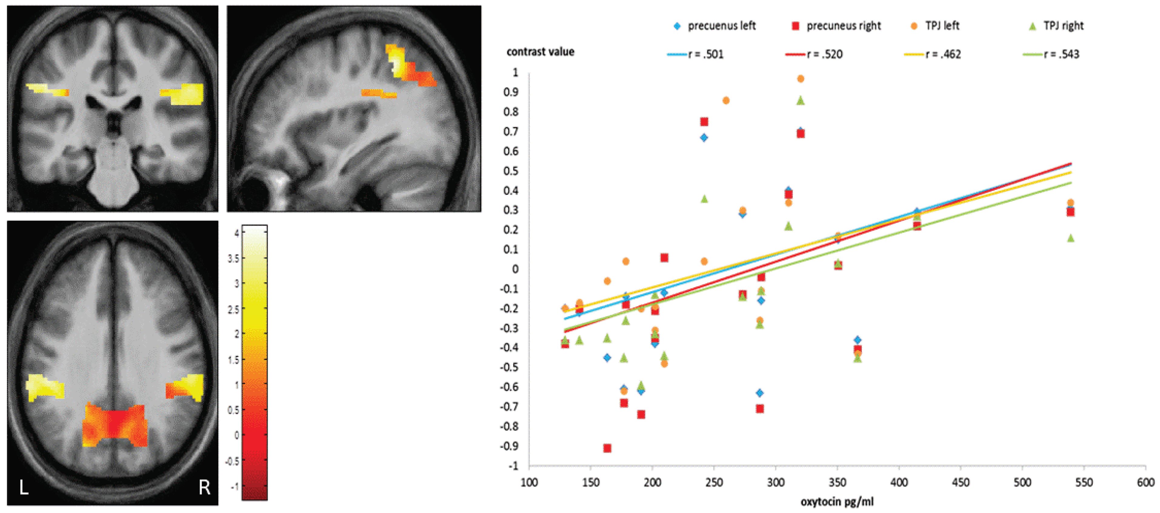 Brainsci 13 01125 g004