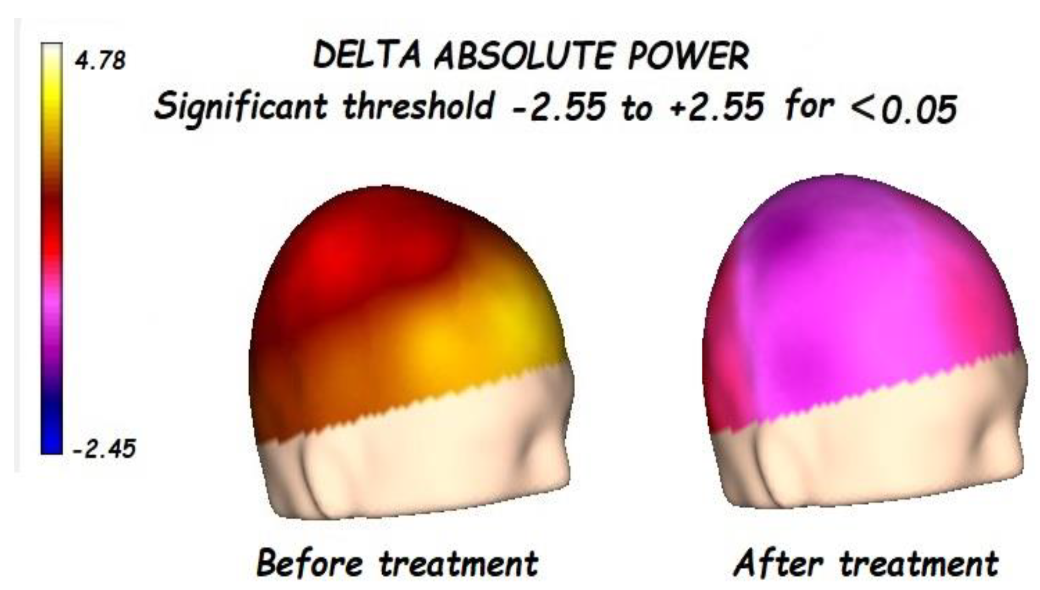 Brainsci 13 01147 g001 Brainsci 13 01147 g001