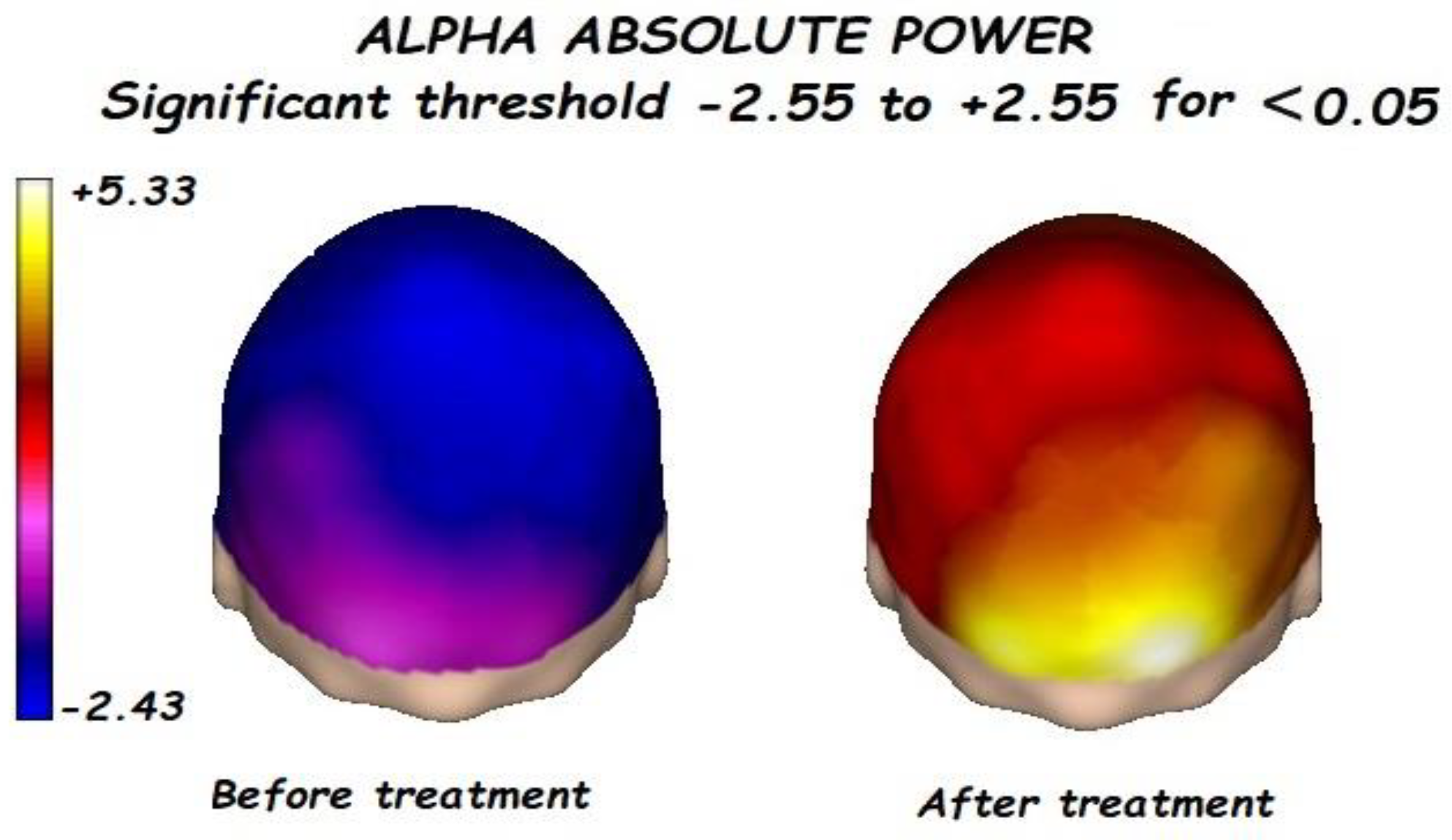 Brainsci 13 01147 g003 Brainsci 13 01147 g003