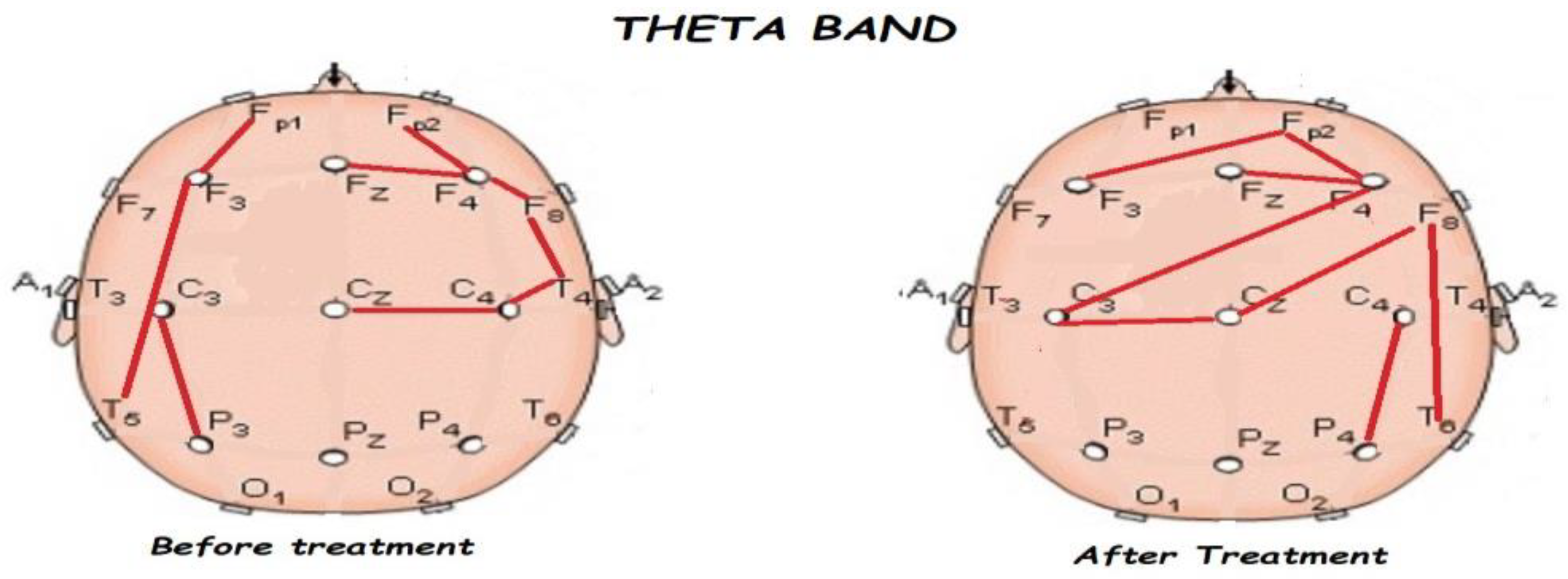 Brainsci 13 01147 g006 Brainsci 13 01147 g006