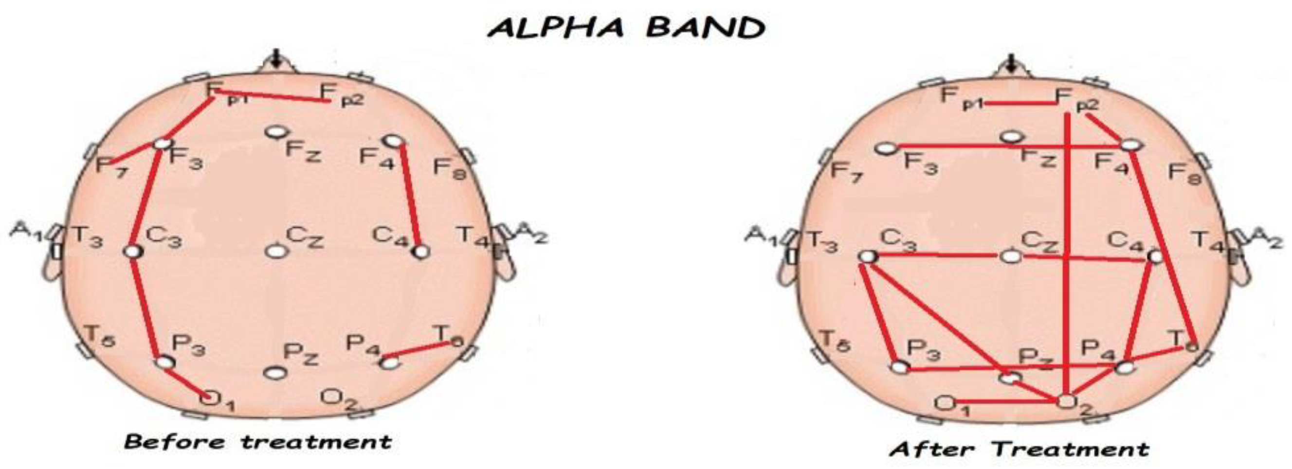 Brainsci 13 01147 g007 Brainsci 13 01147 g007