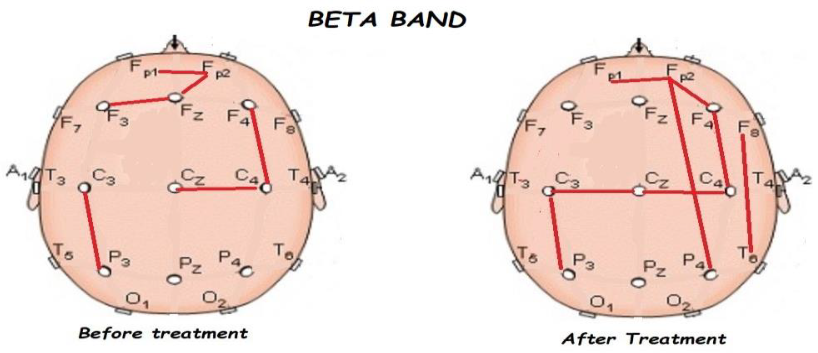 Brainsci 13 01147 g008 Brainsci 13 01147 g008
