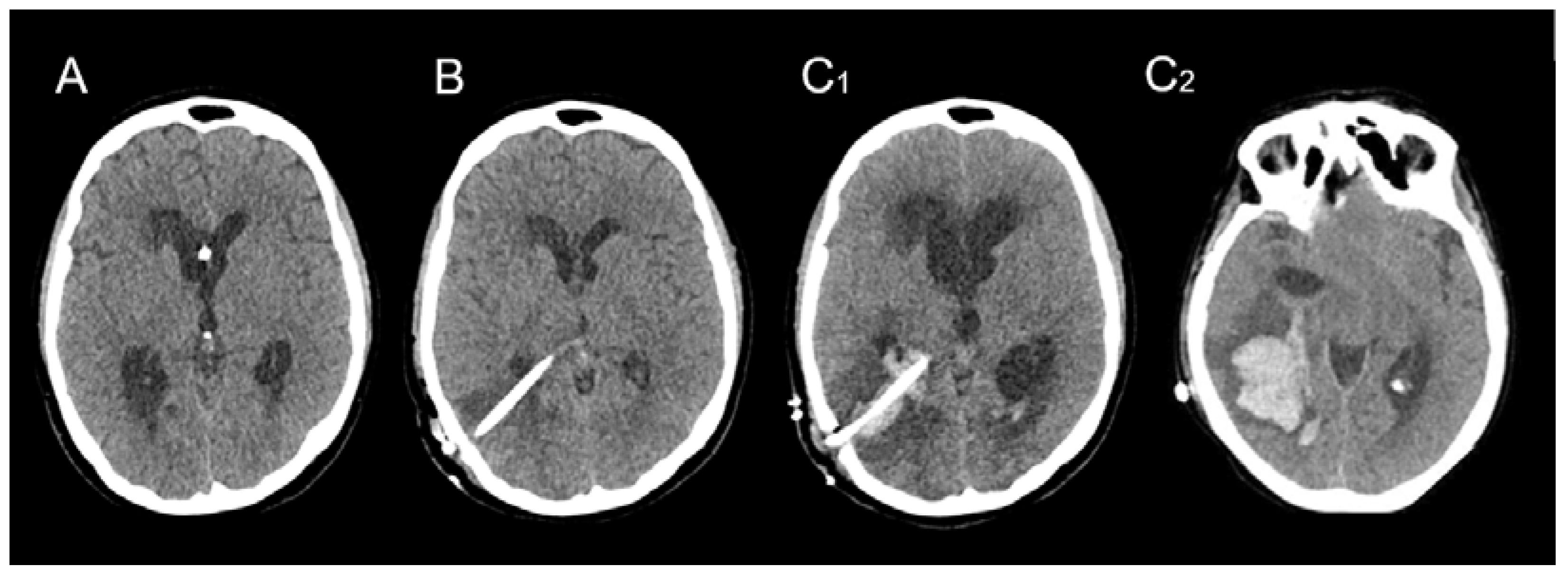 Brainsci 13 01159 g004 Brainsci 13 01159 g004