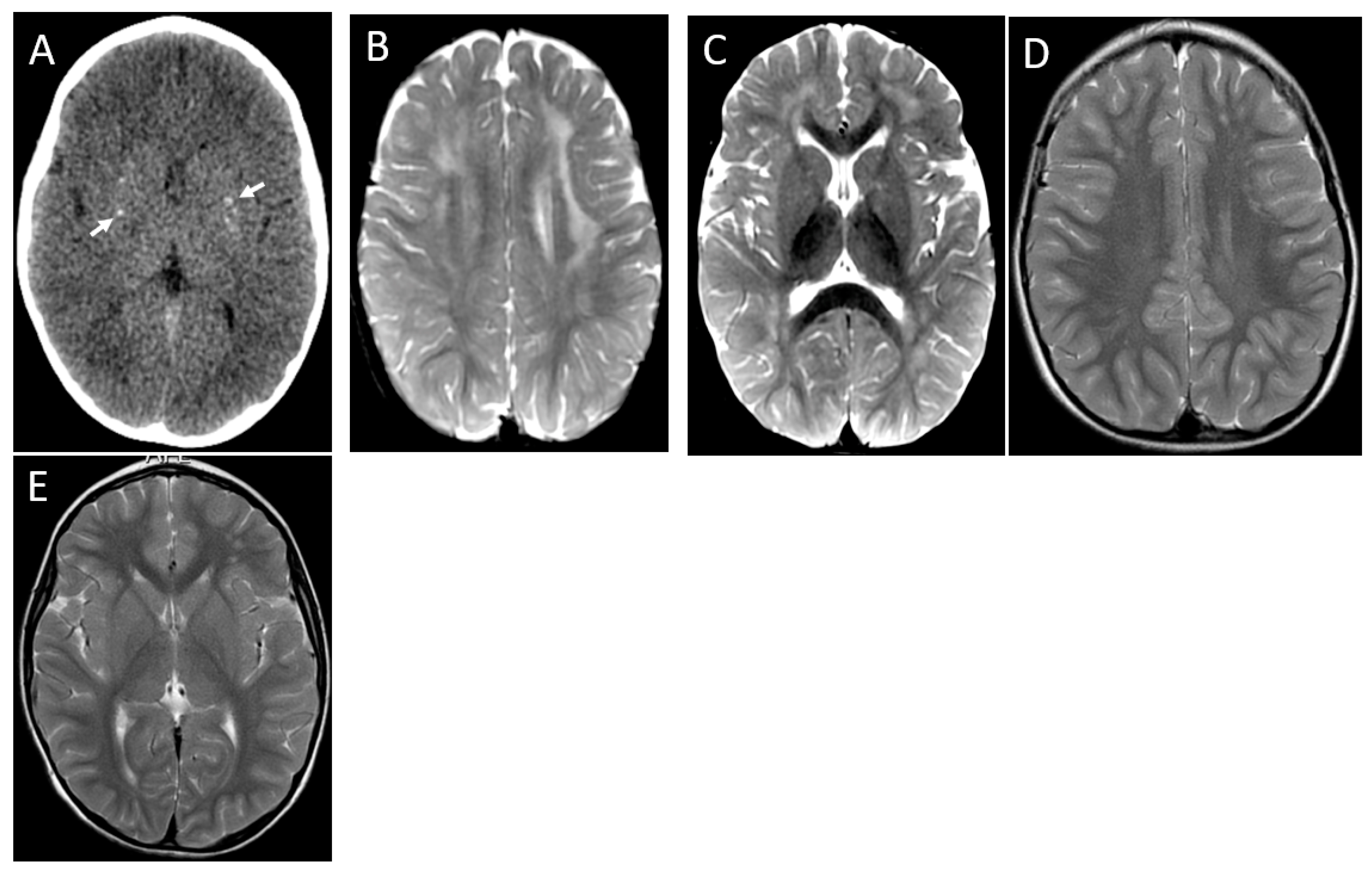 Brainsci 13 01169 g005 Brainsci 13 01169 g005