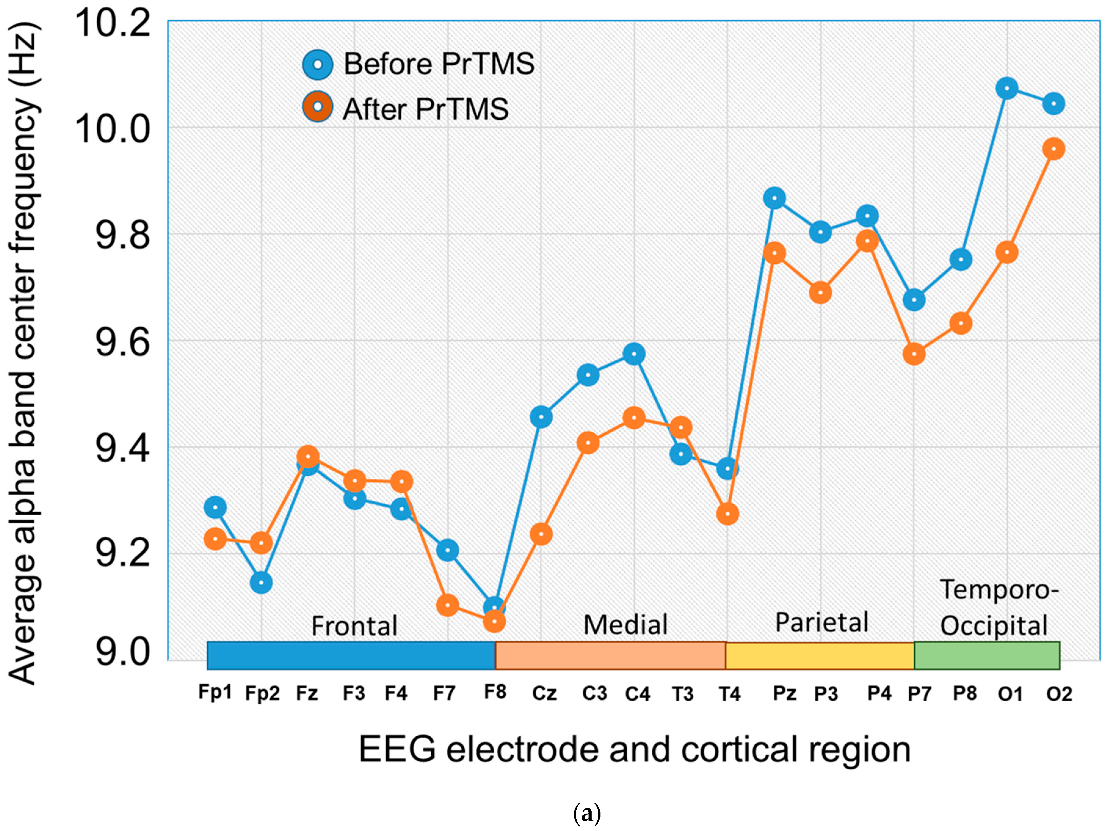 Brainsci 13 01179 g005a Brainsci 13 01179 g005a