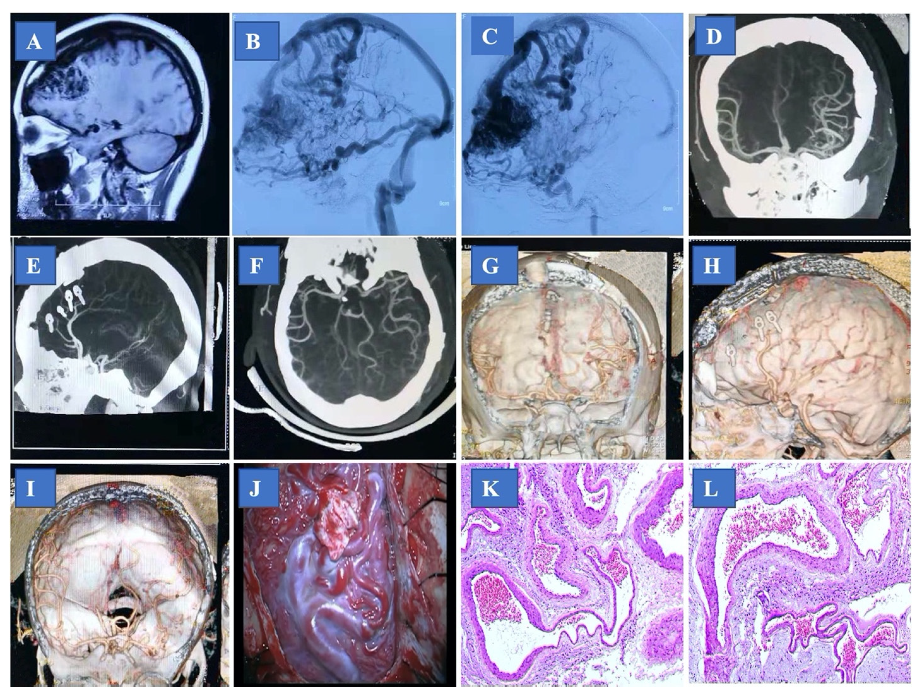 Brainsci 13 01183 g003