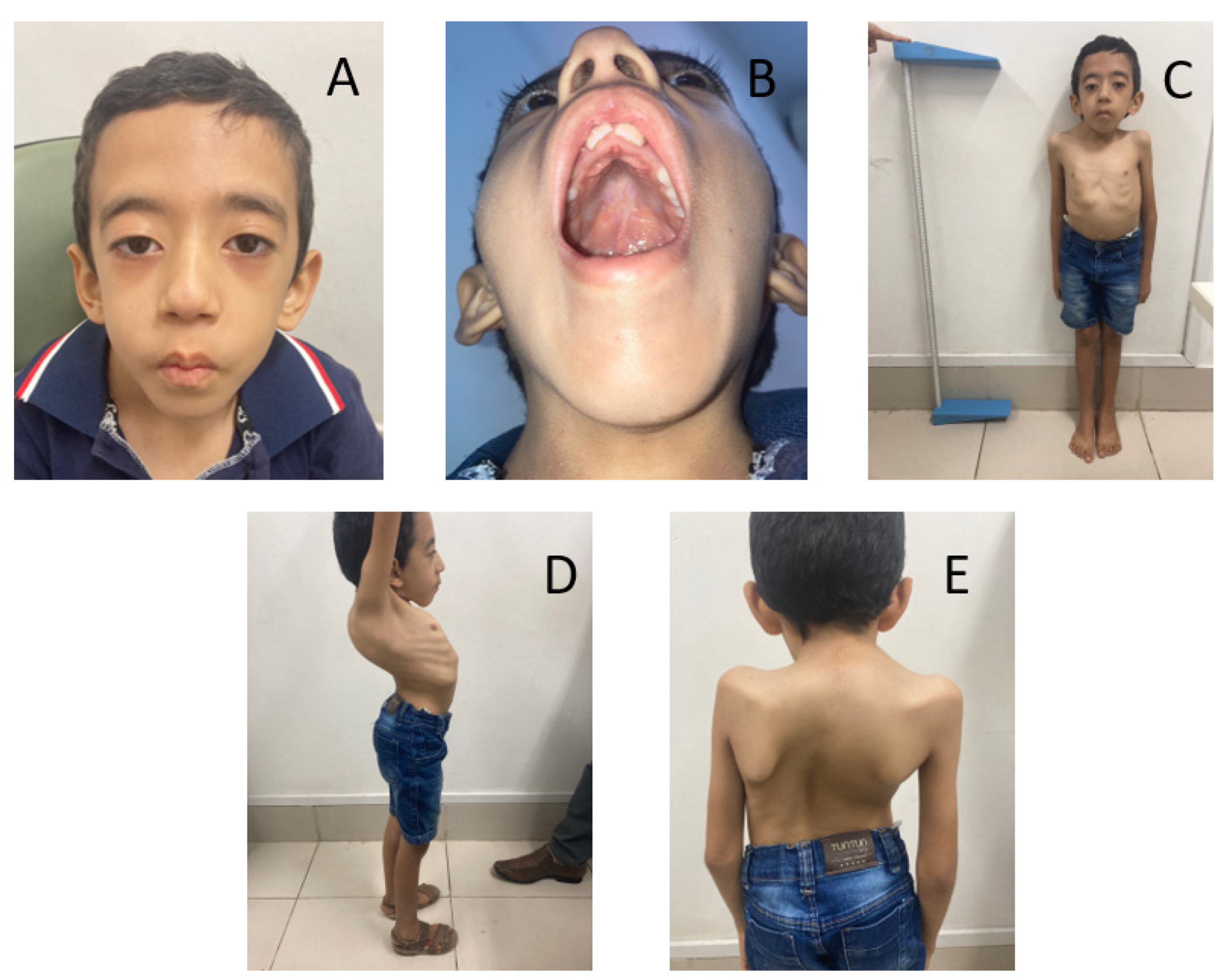 Brainsci 13 01184 g001