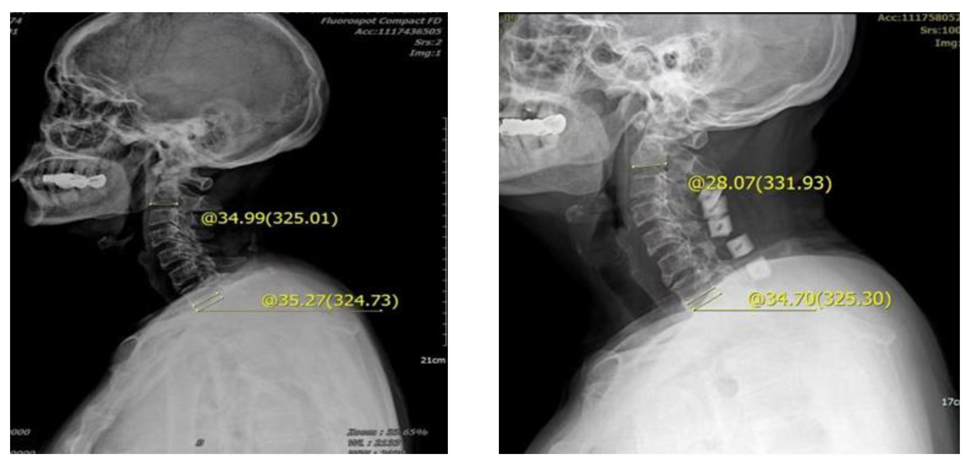 Brainsci 13 01189 g004