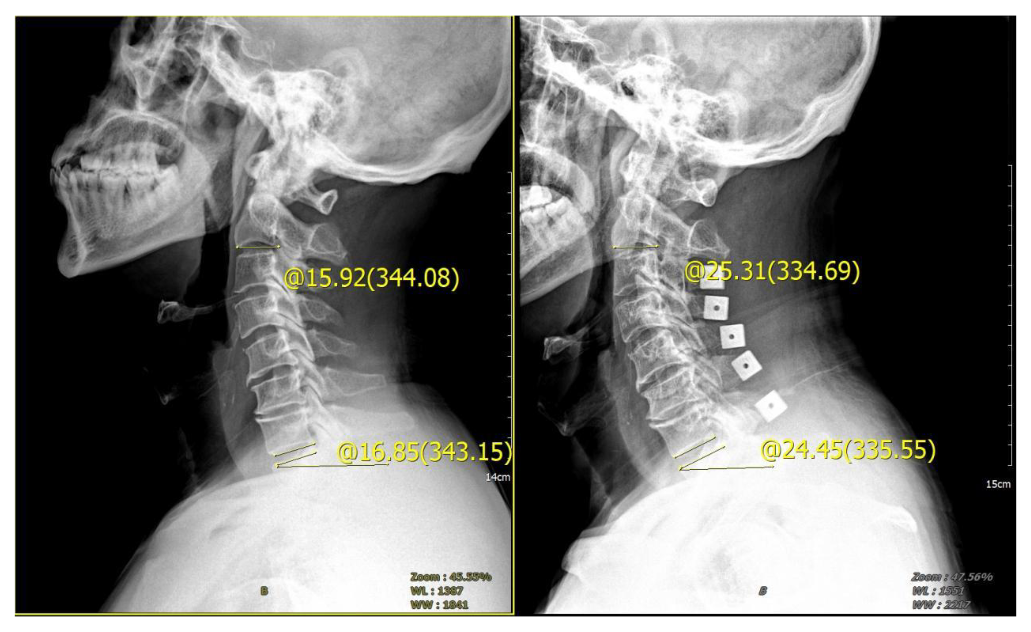 Brainsci 13 01189 g005