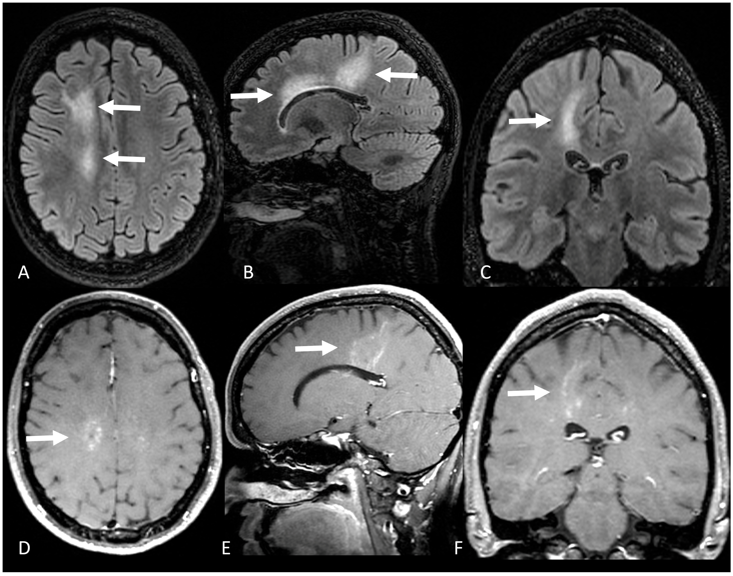 Brainsci 13 01191 g002