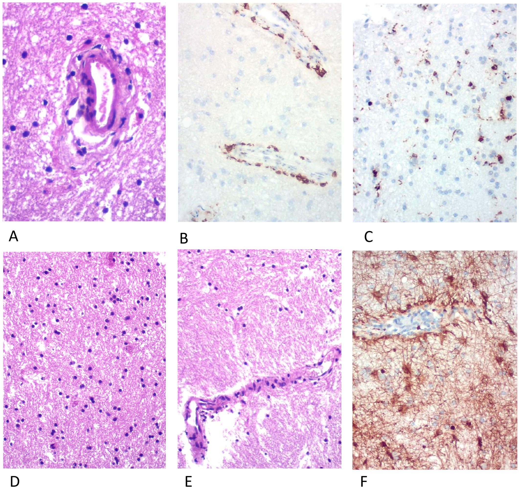 Brainsci 13 01191 g003
