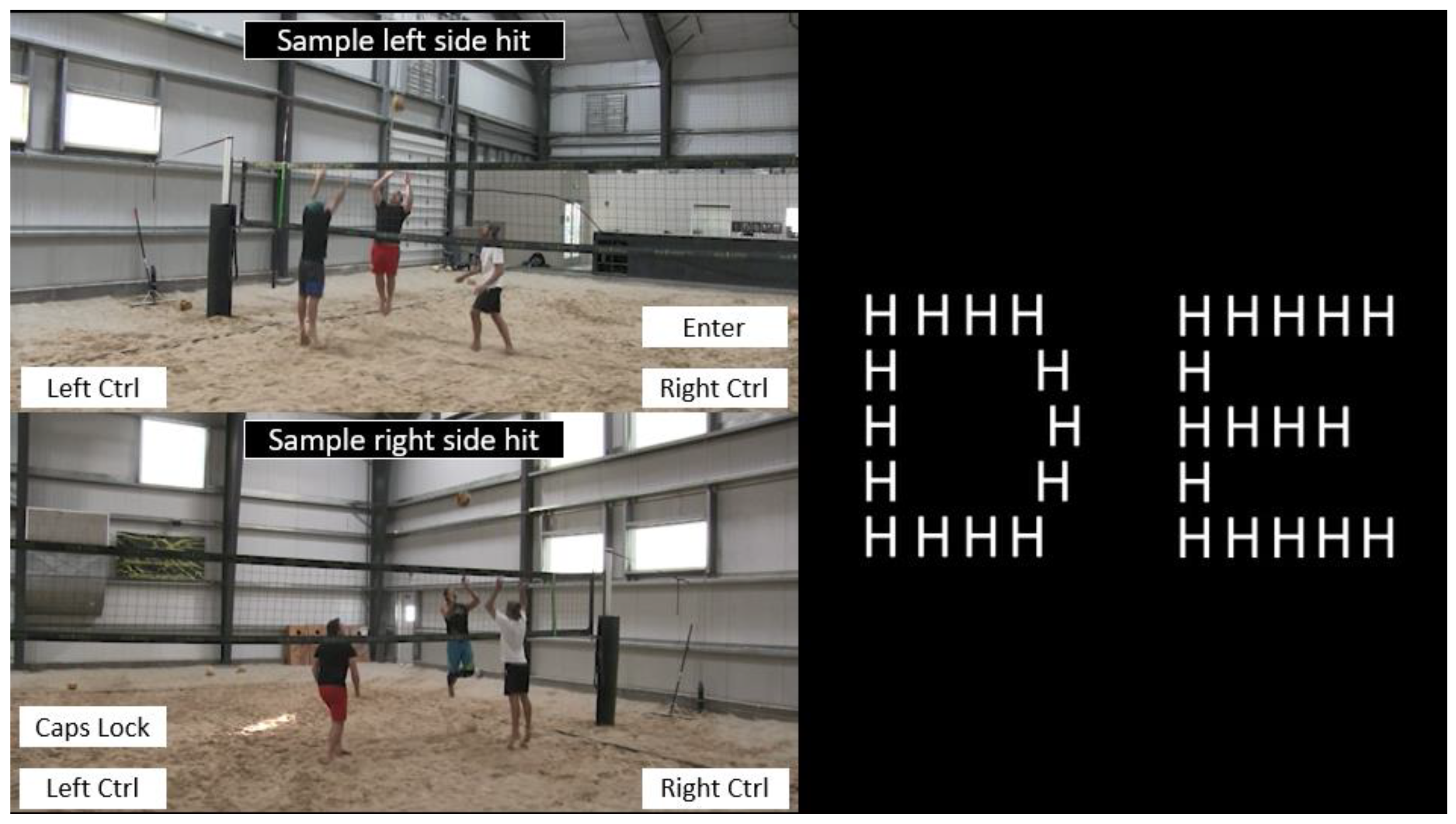 Brain Sciences Free Full-Text Skilled Performers Show Right Parietal Lateralization during Anticipation of Volleyball Attacks image picture
