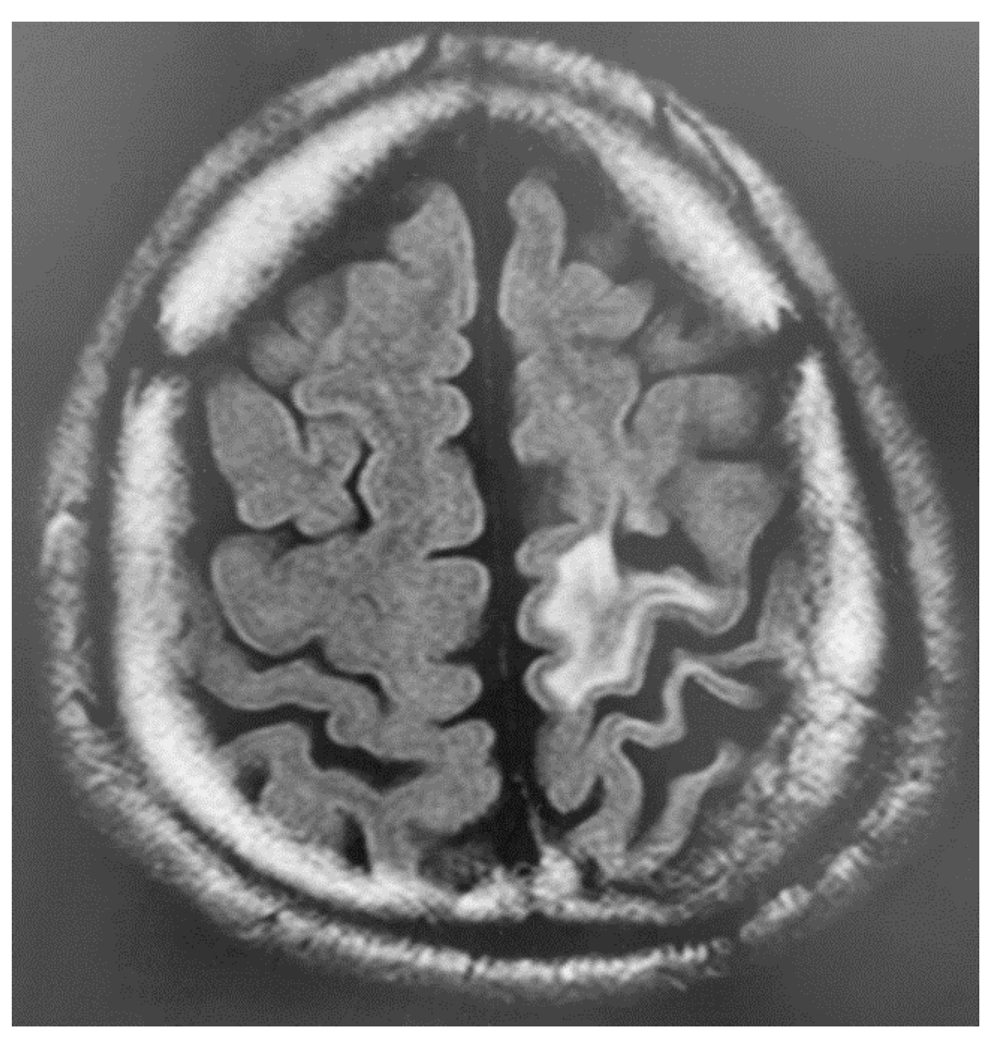 Brainsci 13 01227 g002 Brainsci 13 01227 g002