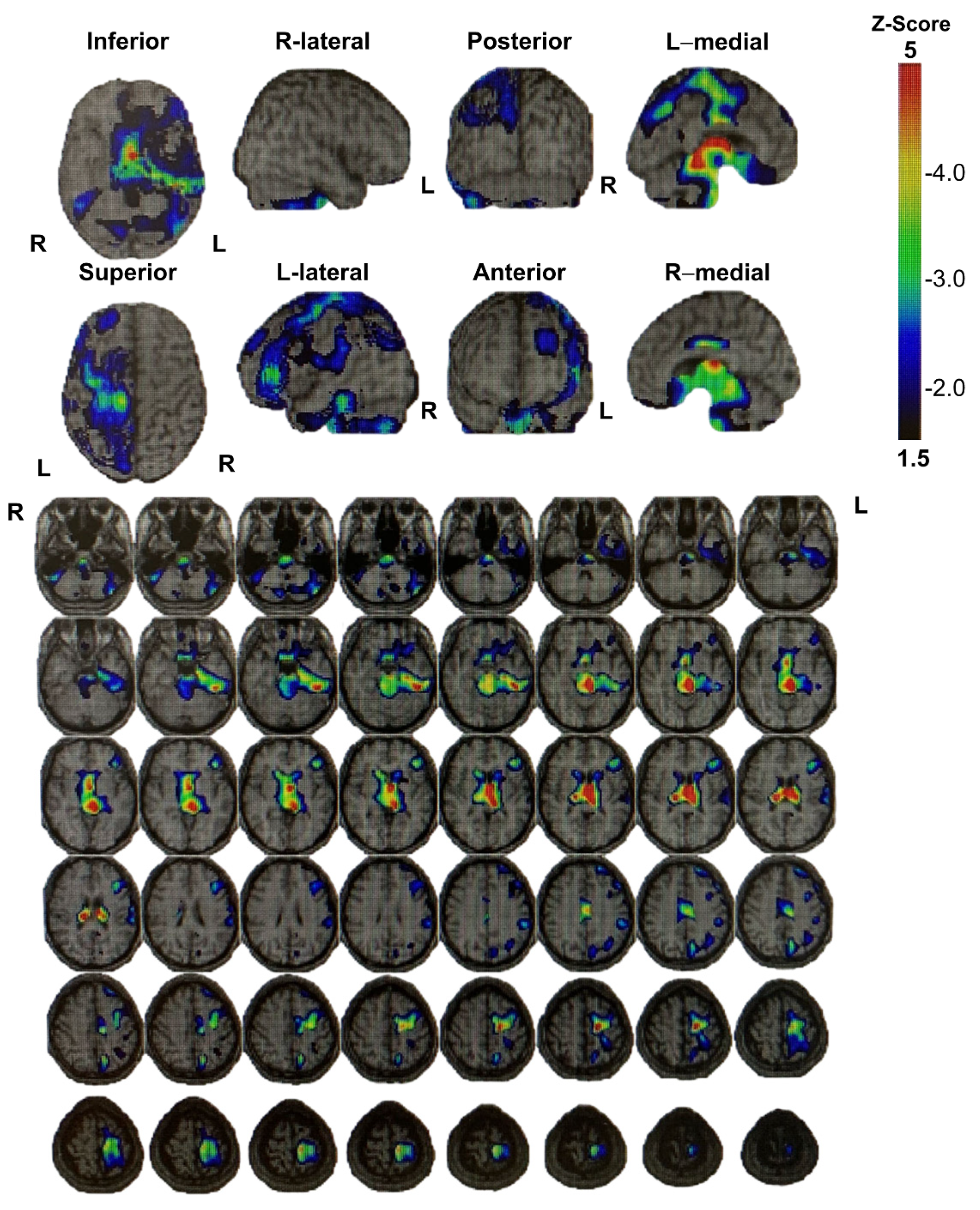 Brainsci 13 01227 g003 Brainsci 13 01227 g003