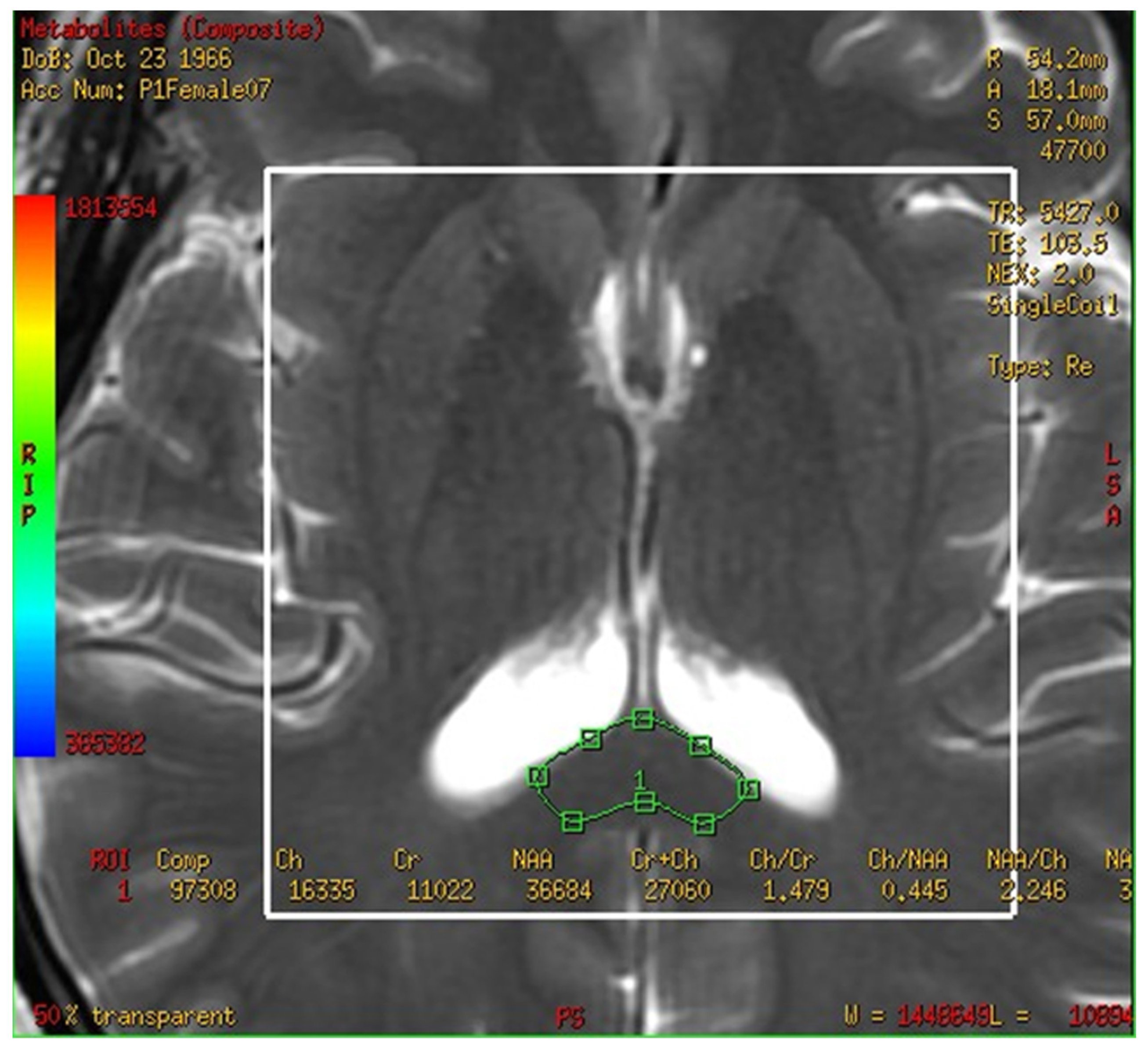 Brainsci 13 01244 g002 Brainsci 13 01244 g002