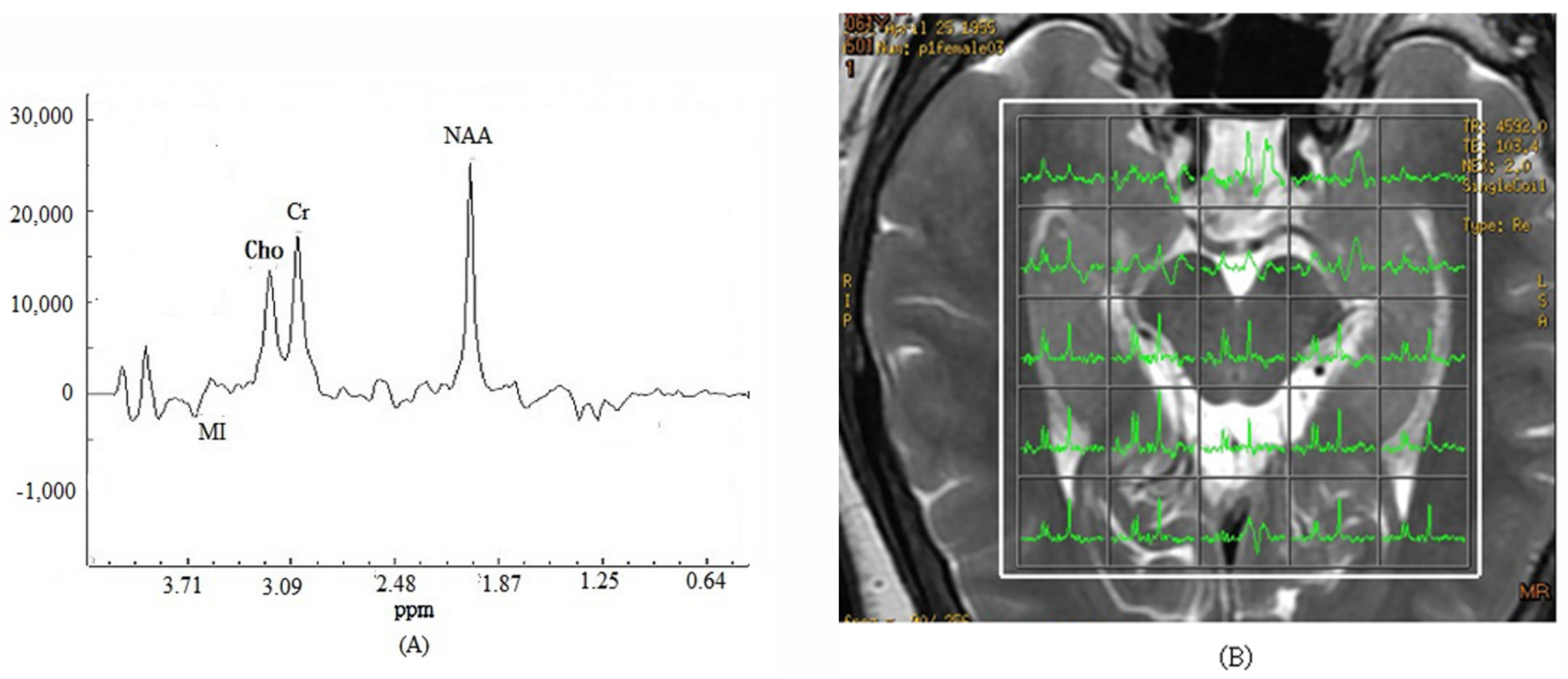 Brainsci 13 01244 g003 Brainsci 13 01244 g003