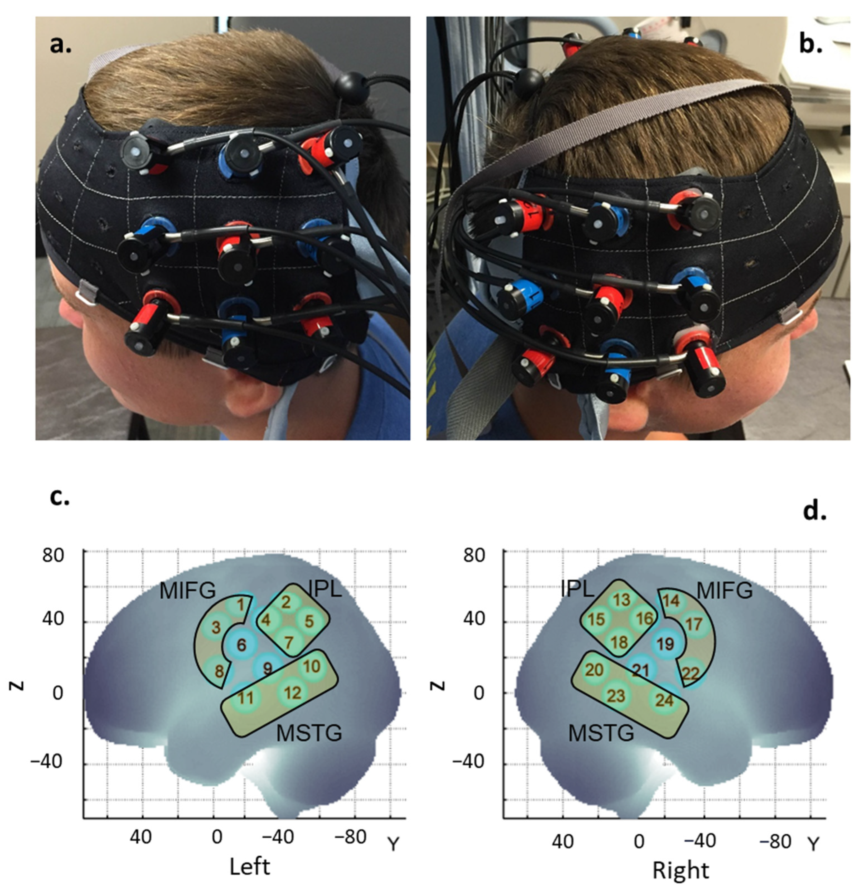 Brainsci 13 01284 g003