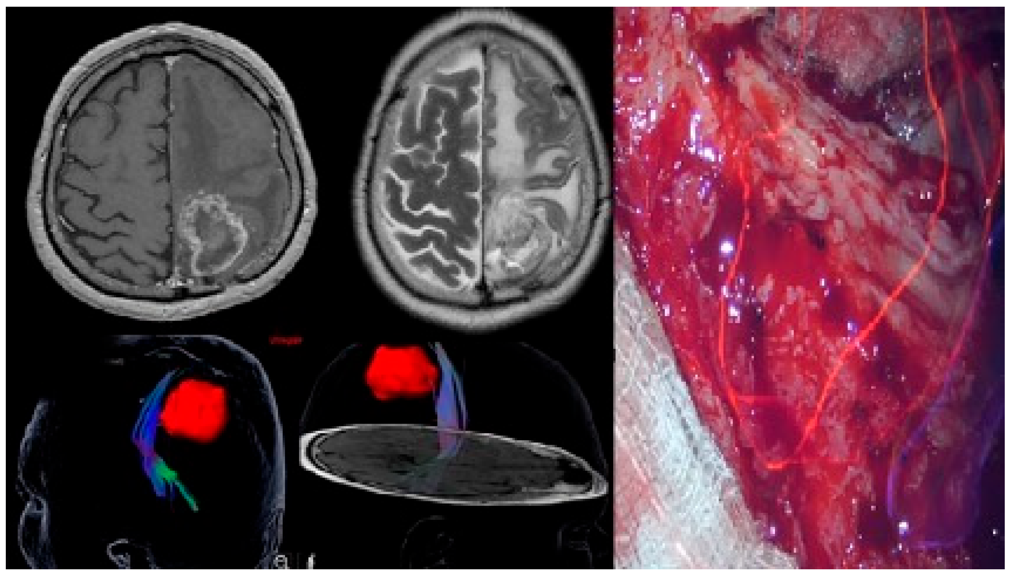 Brainsci 13 01307 g003