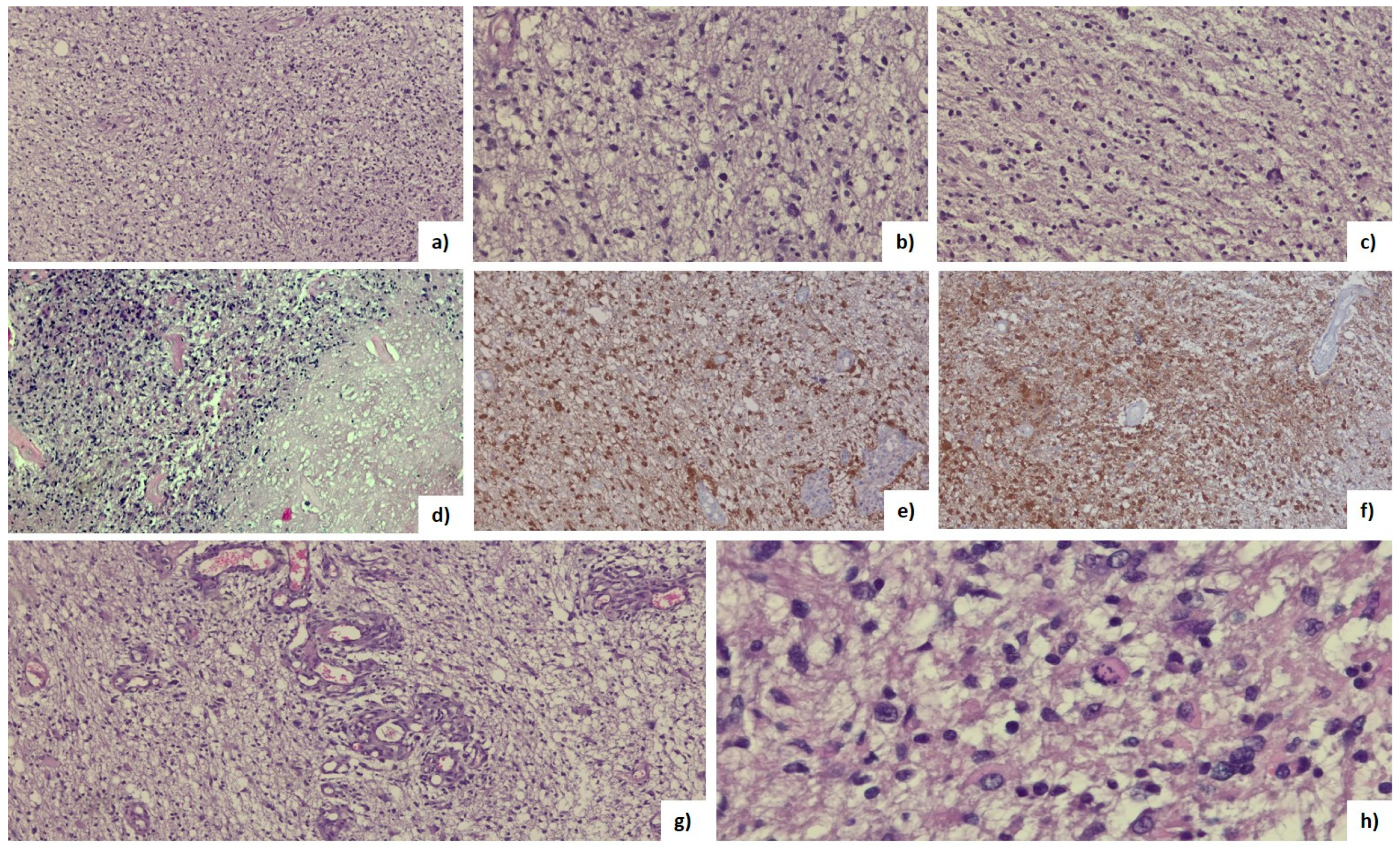 Brainsci 13 01307 g004