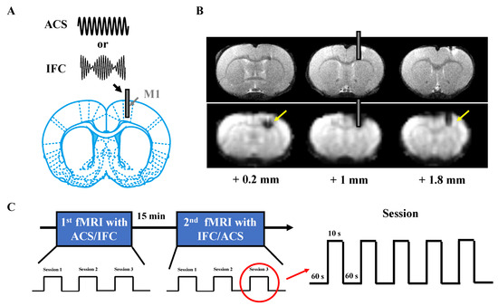 Brain Response to Interferential Current Compared with