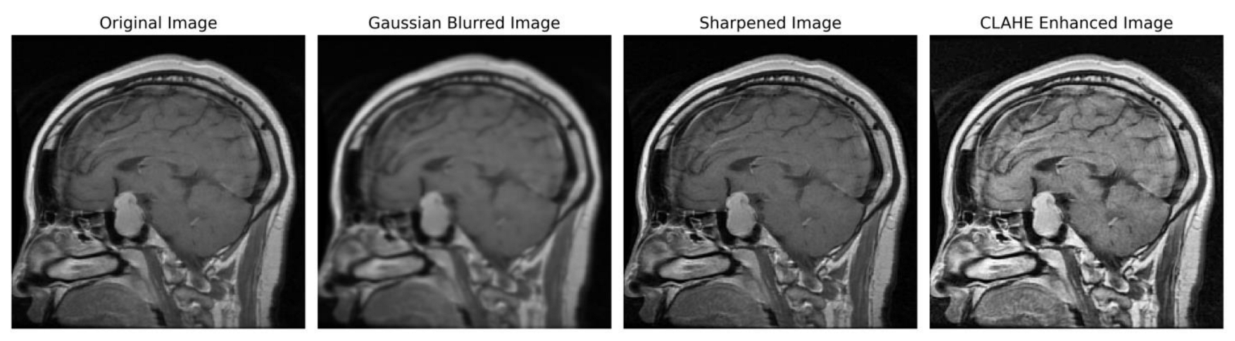 Brainsci 13 01320 g003