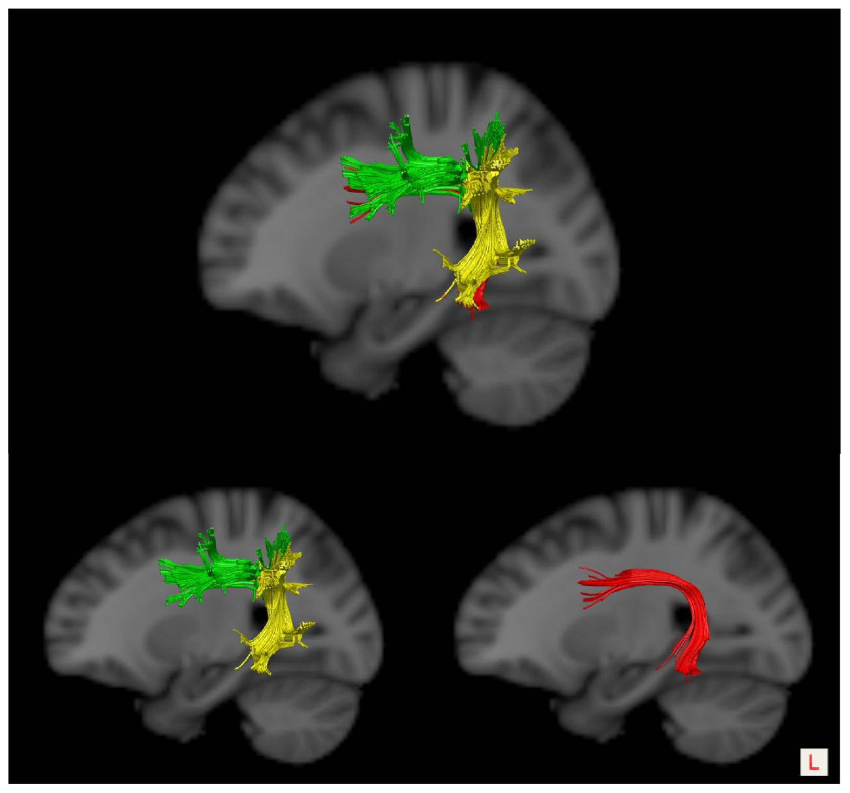 Brainsci 13 01324 g001