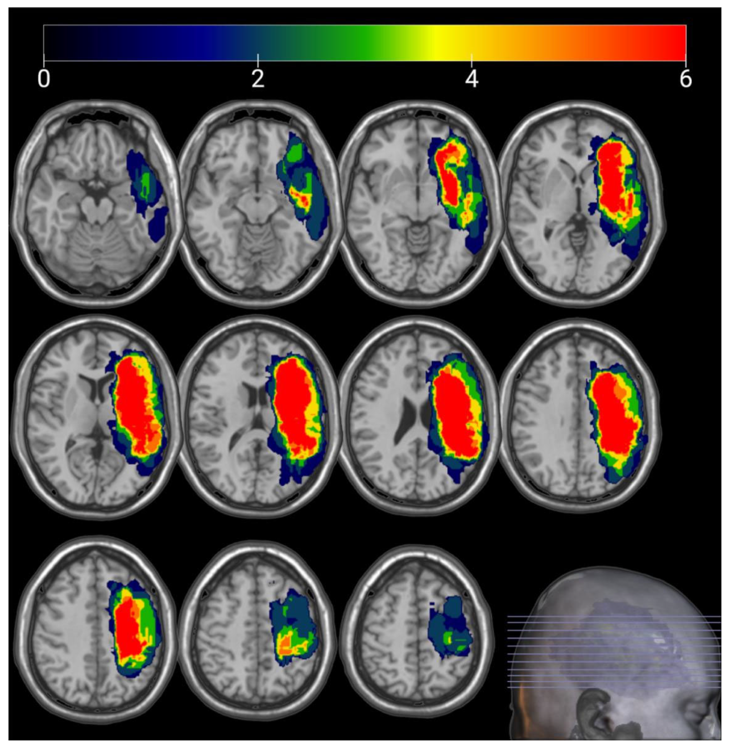 Brainsci 13 01324 g003