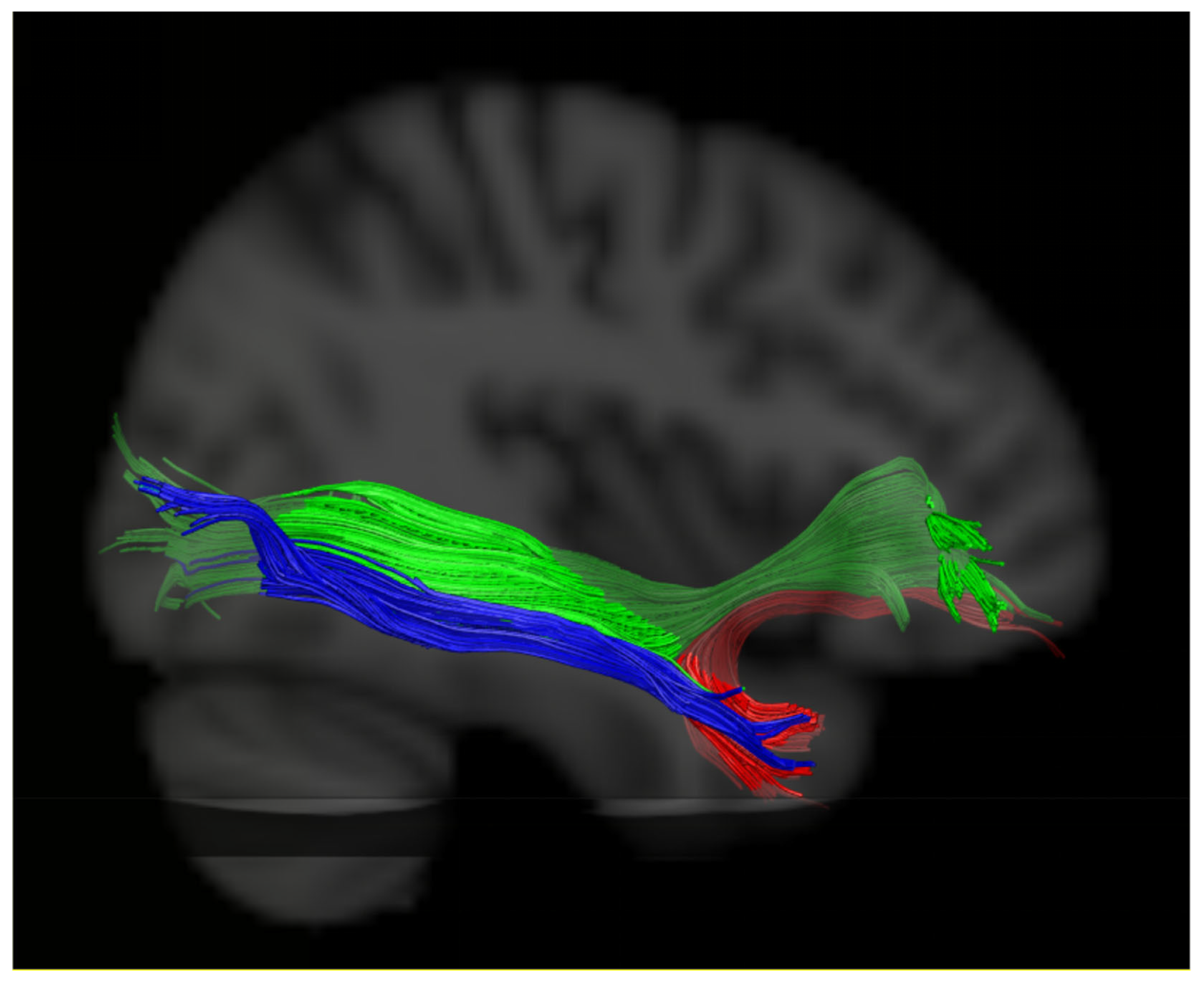 Brainsci 13 01324 g004