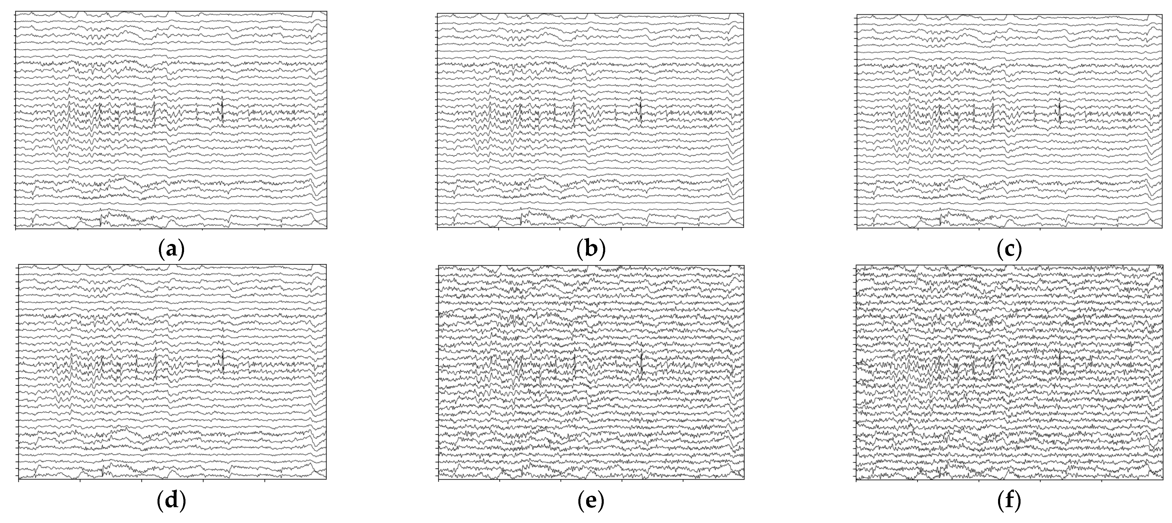 Brainsci 13 01326 g013