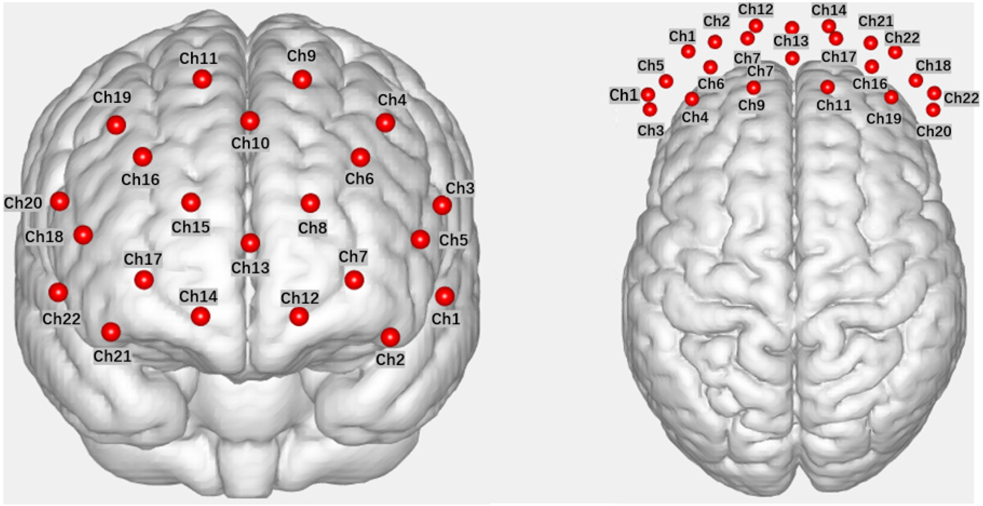Brainsci 13 01330 g002