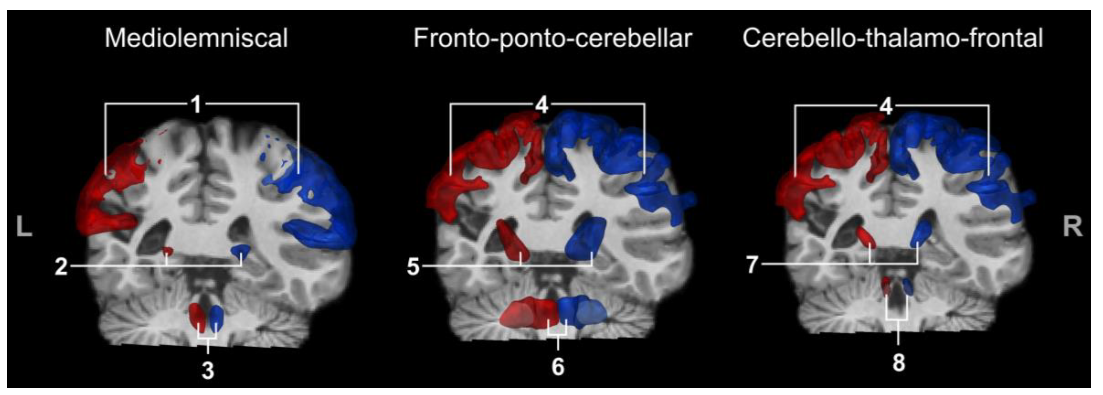 Brainsci 13 01386 g002